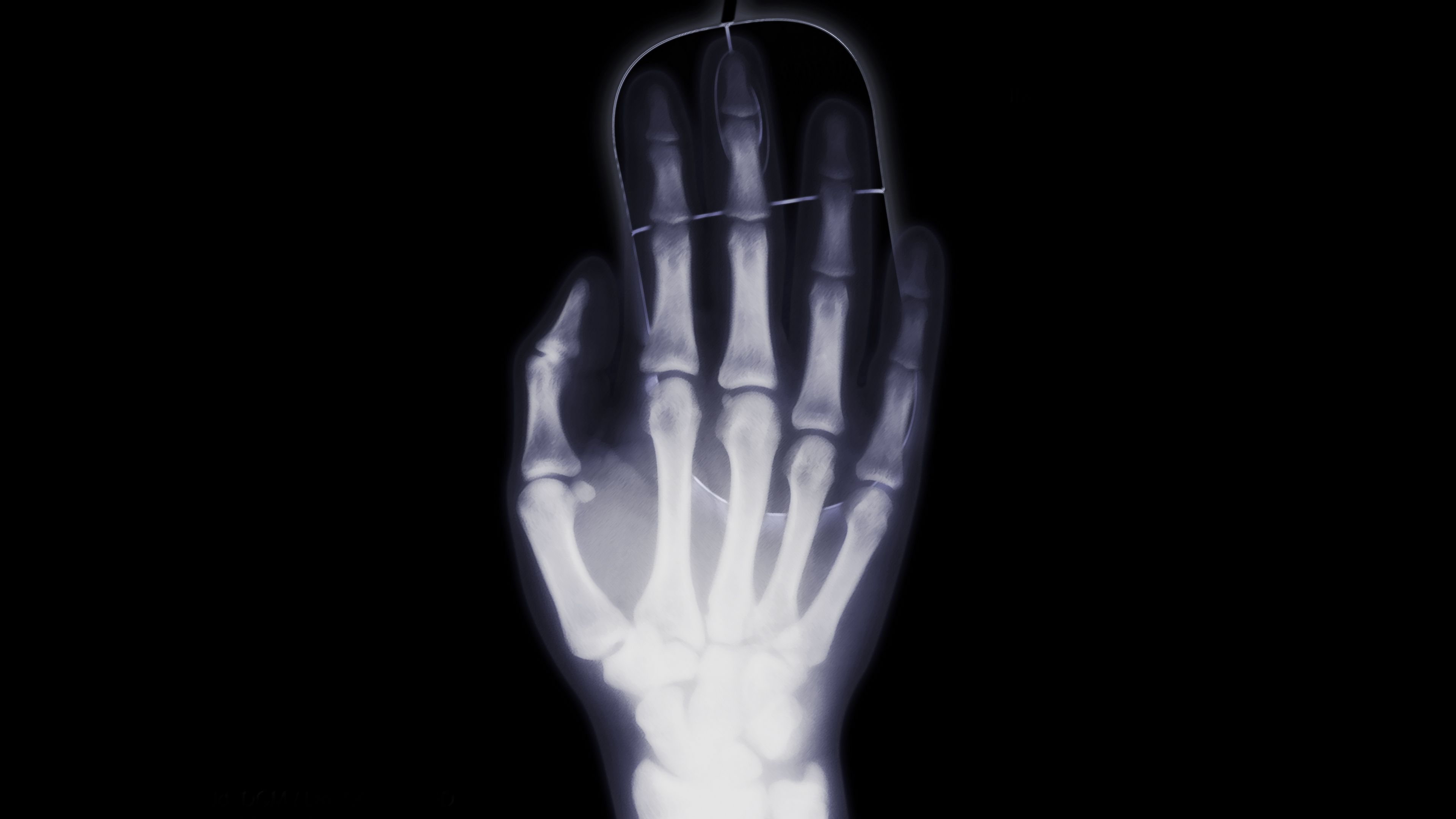 arm, x-ray, bone, computer mouse, 4k, HD Wallpaper