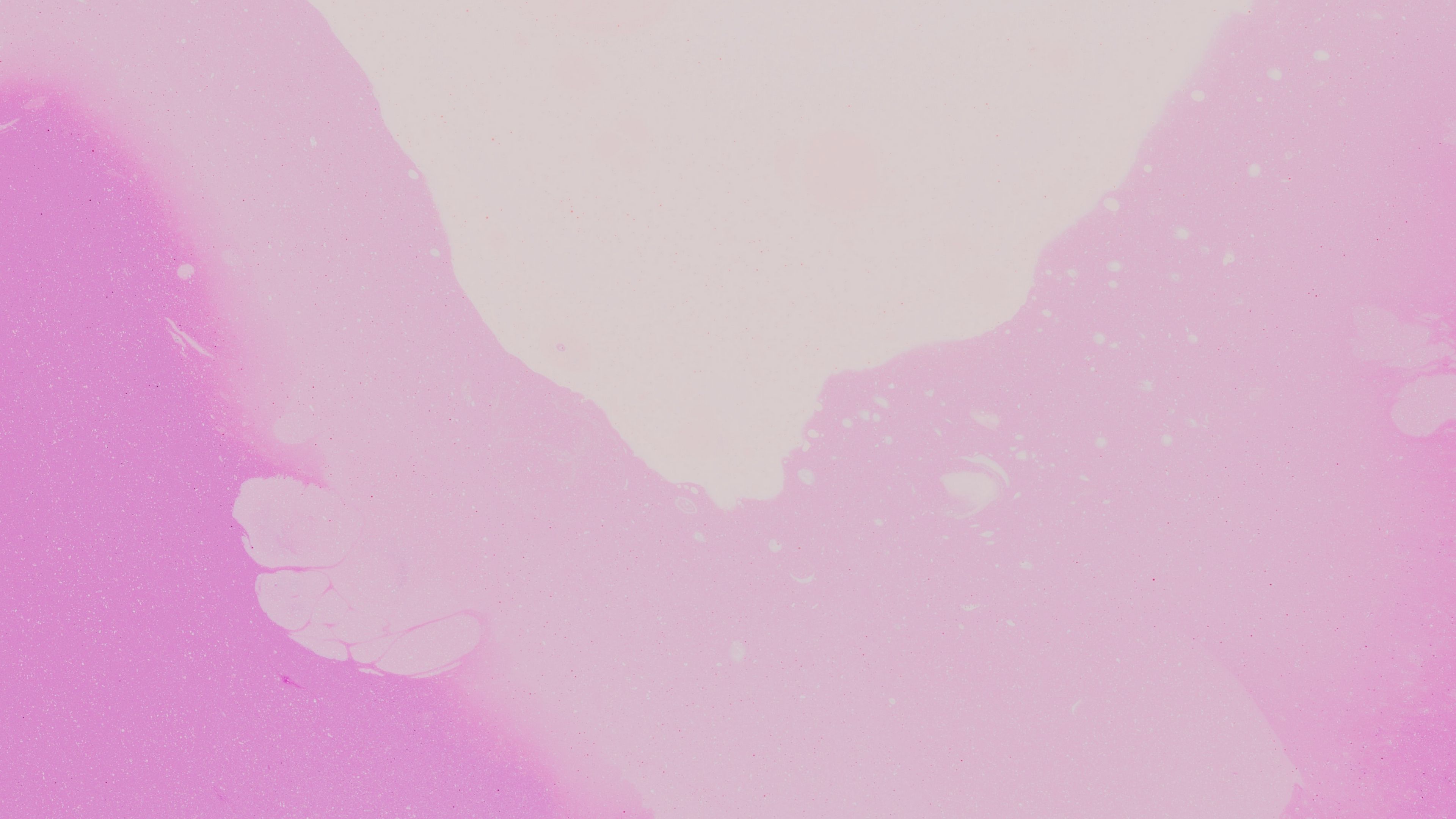 spots, abstraction, purple, 4k, HD Wallpaper