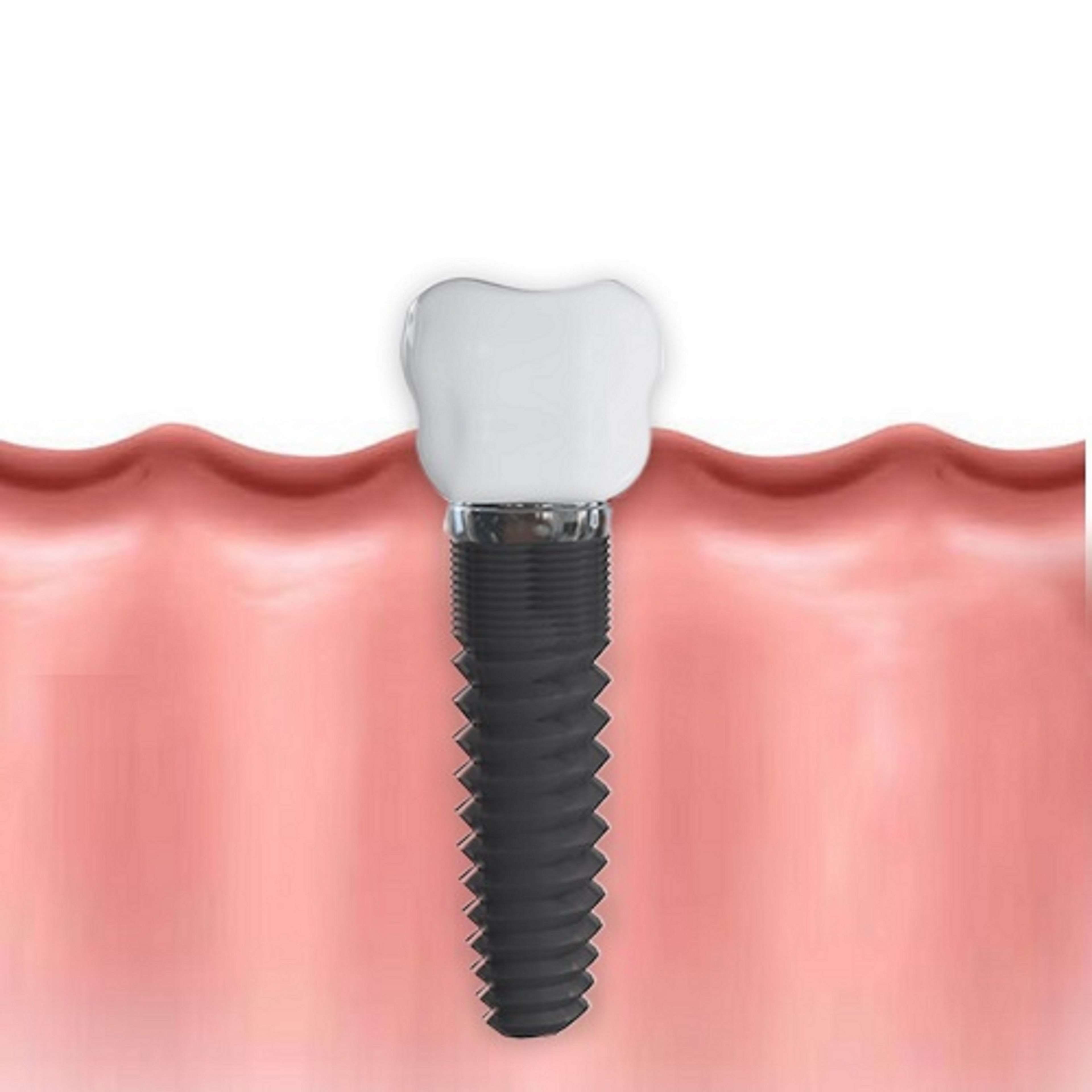 tooth, 4K, pink color, work tool, industry, dental, white background, metal, extreme close-up, teeth, strength, health, no people, black color, dentist, Phone HD Wallpaper