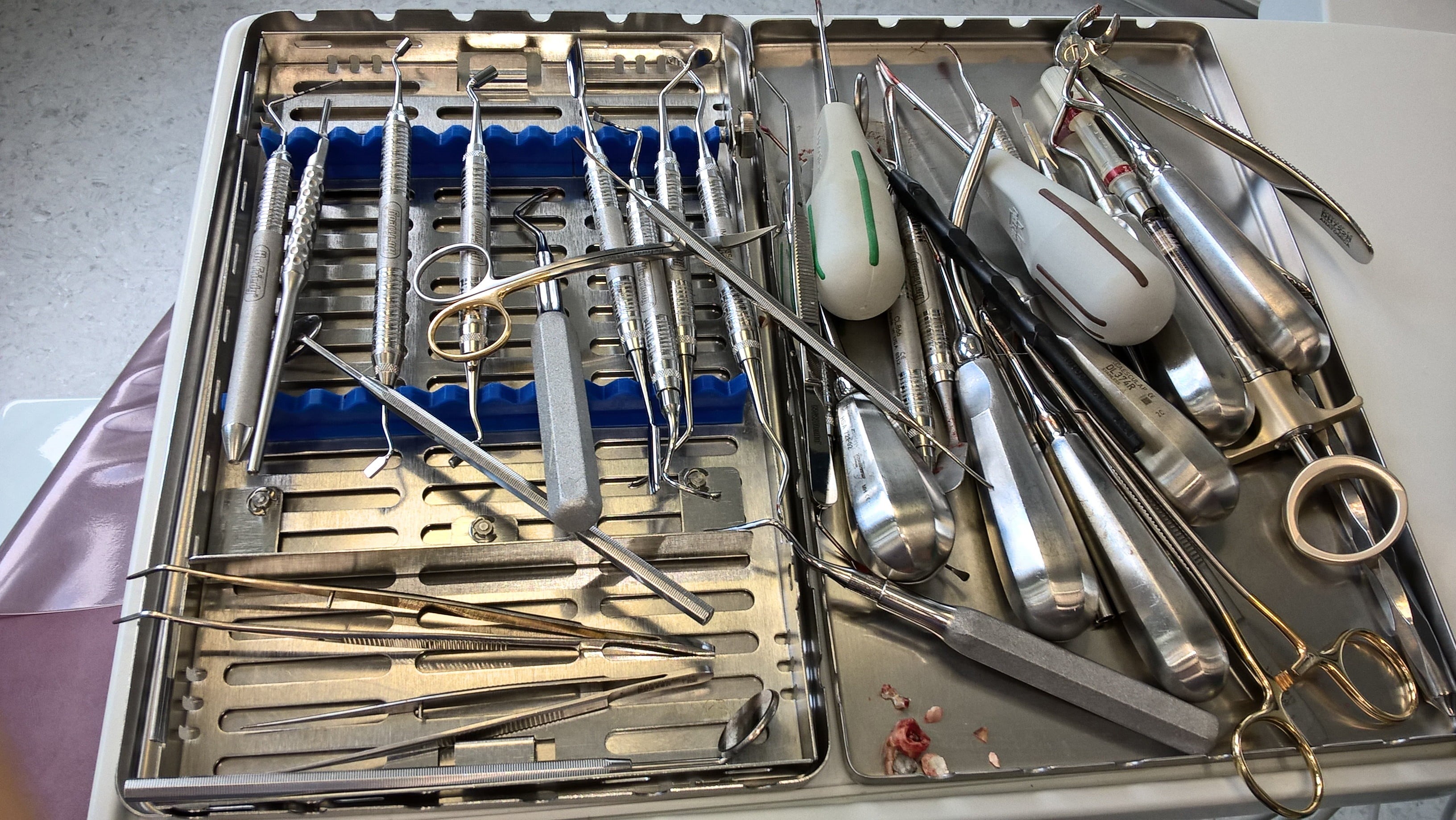 still life, high angle view, teeth, household equipment, kitchen utensil, no people, kit, order, domestic room, eating utensil, close-up, tooth, tool, silver colored, HD Wallpaper