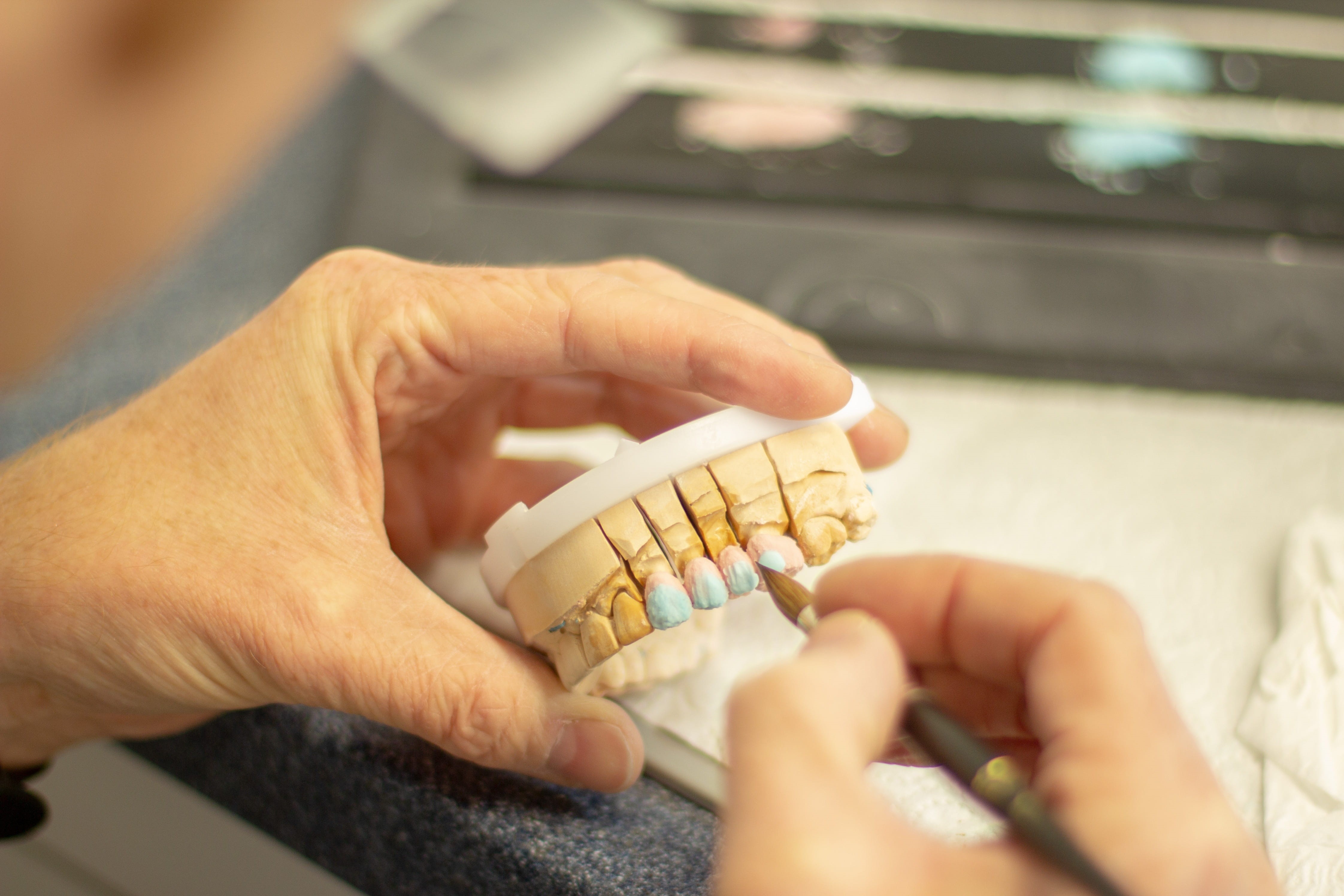 dentistry, clinic, applying, occupation, human body part, close-up, finance, healthcare and medicine, person, indoors, technology, equipment, hand, human hand, HD Wallpaper