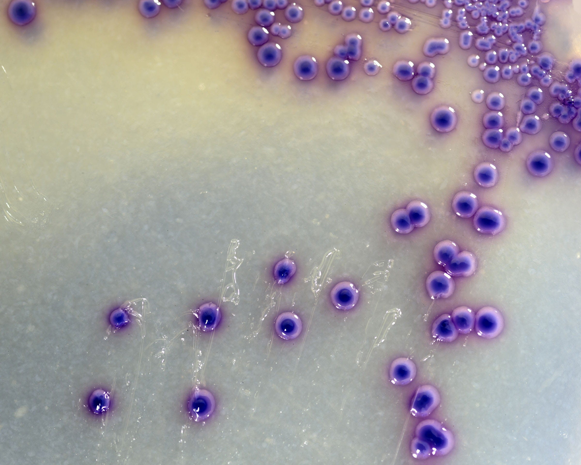 e. coli, pathogen, petri, sickness, morphology, sanitation, air, biotechnology, inspection, risk, growing, food and drink, fungi, agar, danger, dish, college, HD Wallpaper