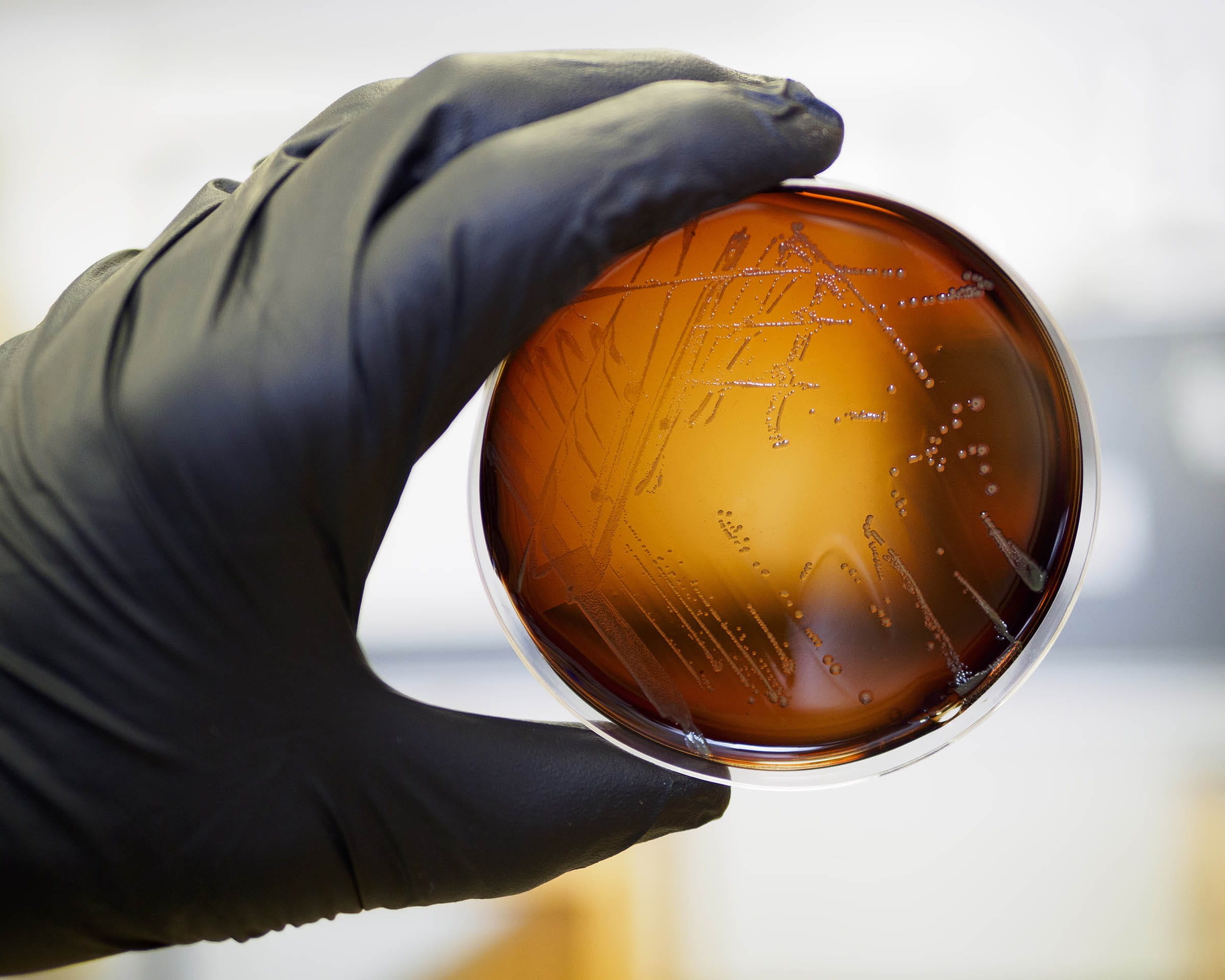 college, holding, science, sphere, toxin, pathogen, discovery, human hand, 1080P, dish, environment, human body part, organism, listeria, hazard, toxic, HD Wallpaper