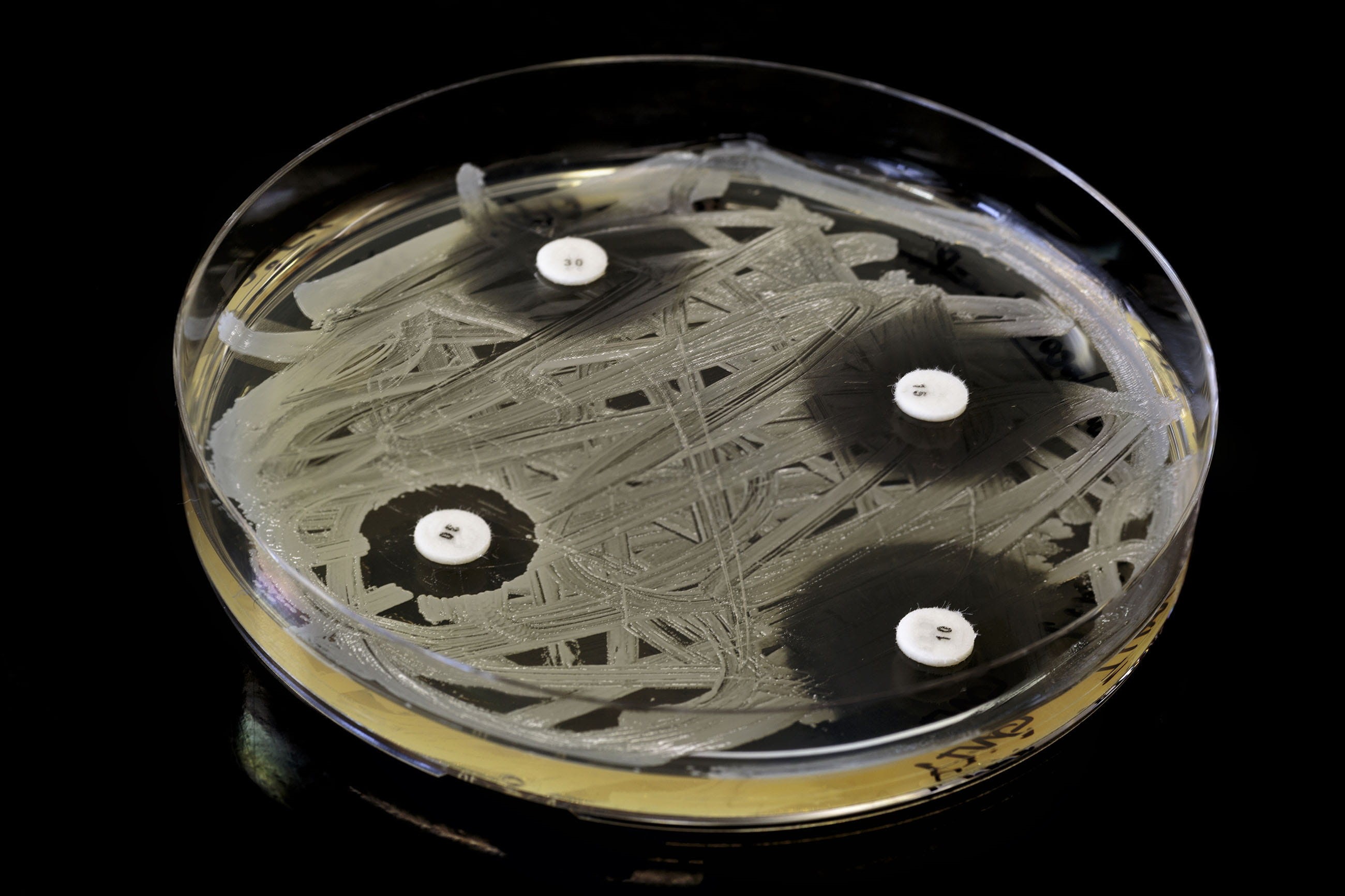 standard, silver colored, concentrations, scientific, education, cut out, antibiotics, agar, metal, petri, drugs, black background, safety, circle, health, HD Wallpaper