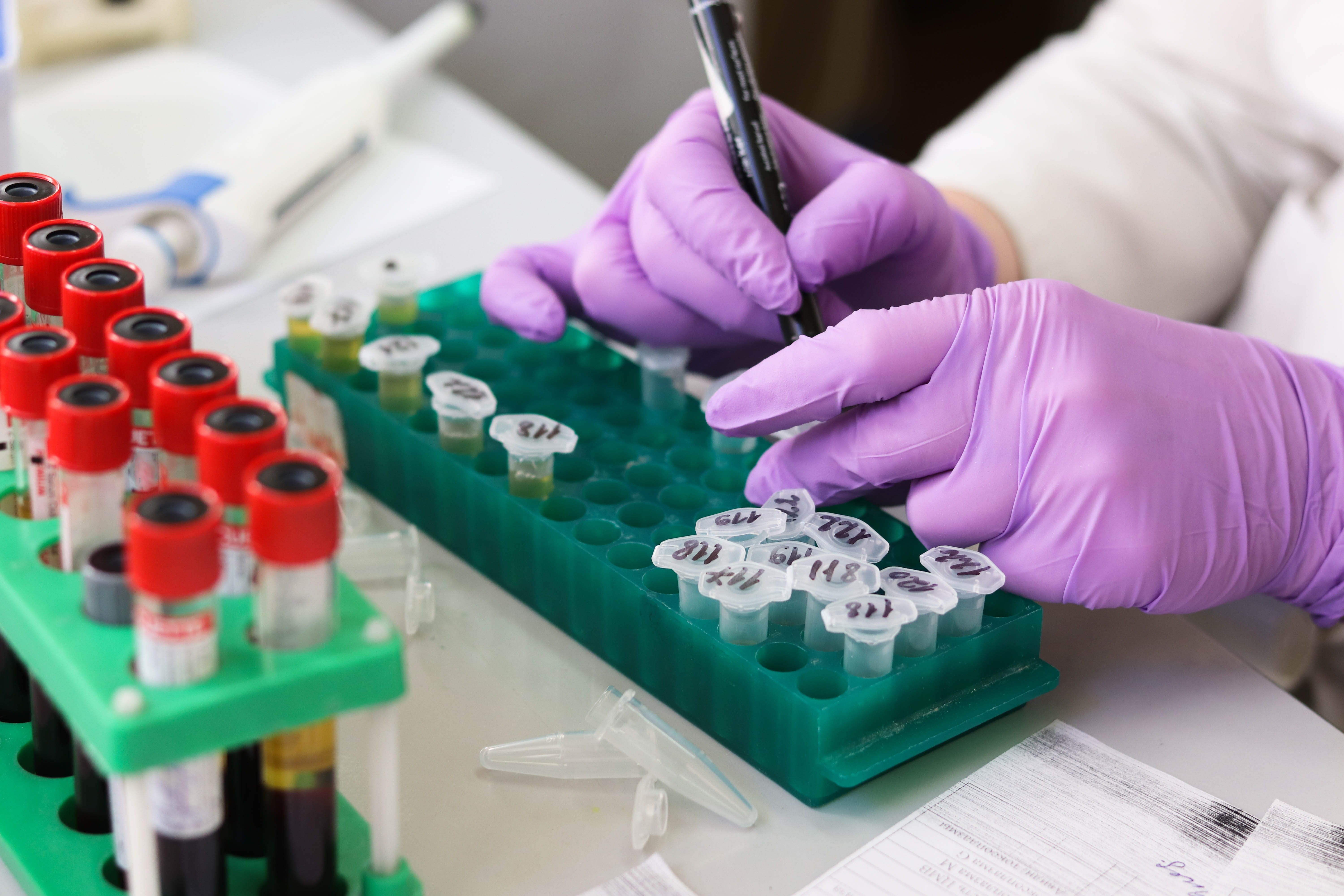 education, analyzing, doctor, blood samples, test, technology, tube, woman, medical, holding, equipment, research, skill, science, healthcare and medicine, HD Wallpaper