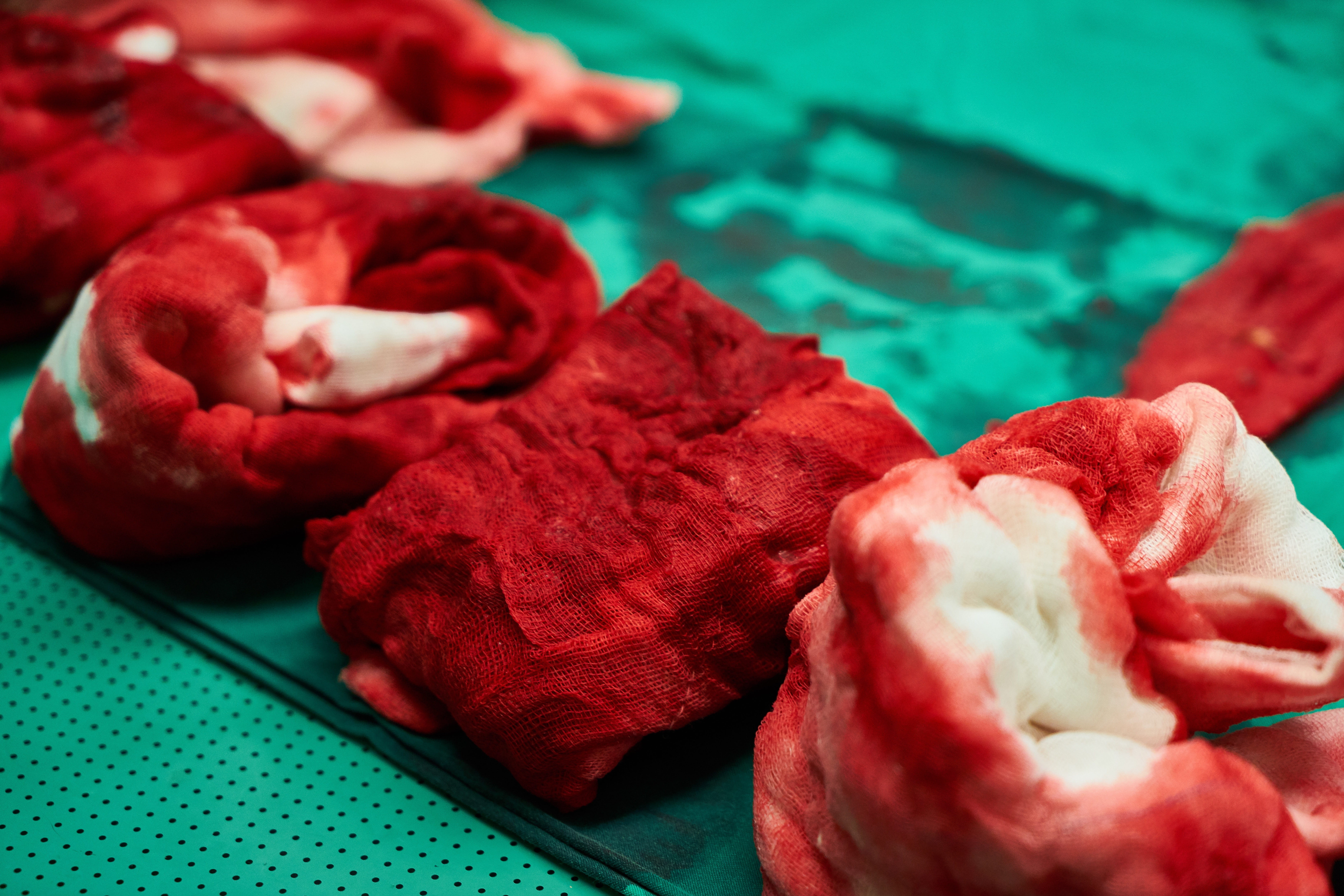 close-up, operating room, blue, raw food, medicine, anesthesia, table, food and drink, doctor, scalpel, textile, selective focus, hygiene, human, surgery, HD Wallpaper
