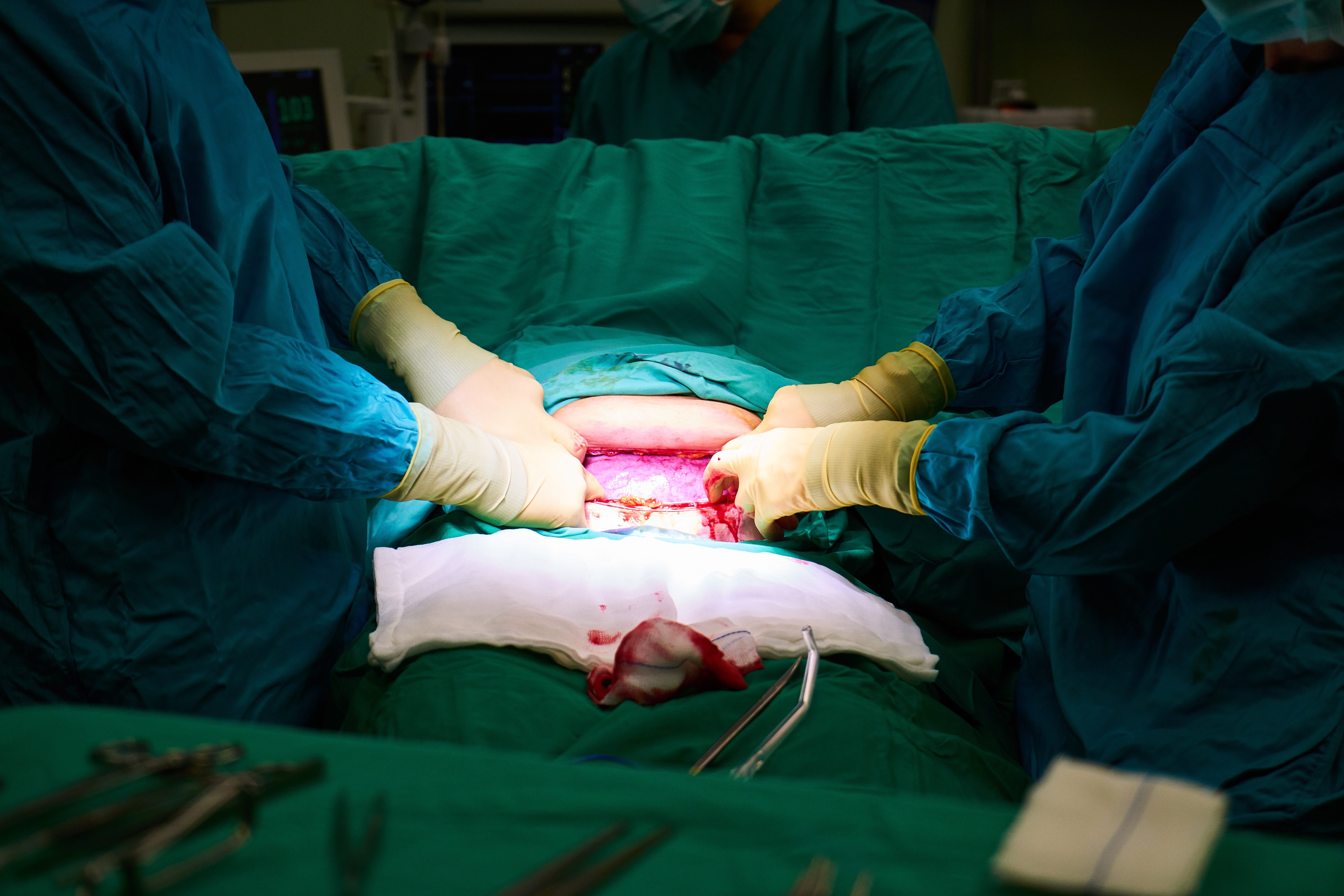 baby, operation, expertise, life, occupation, scissors, adult, new born, breed, scalpel, birth, medicine, teamwork, healthcare worker, childhood, protection, HD Wallpaper