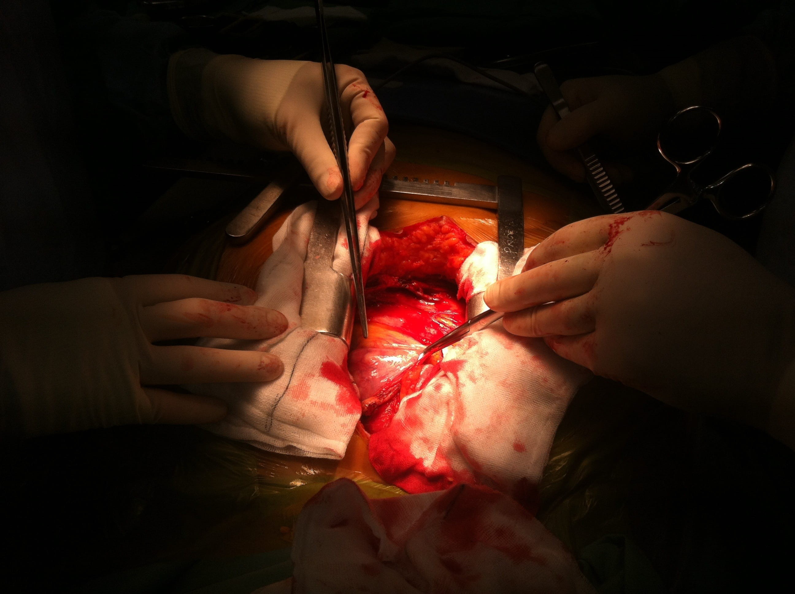 heart, health, responsibility, Operation, human, hospital, body part, surgical equipment, Surgery, open, 2K, science, medical procedure, operate, human body part, HD Wallpaper