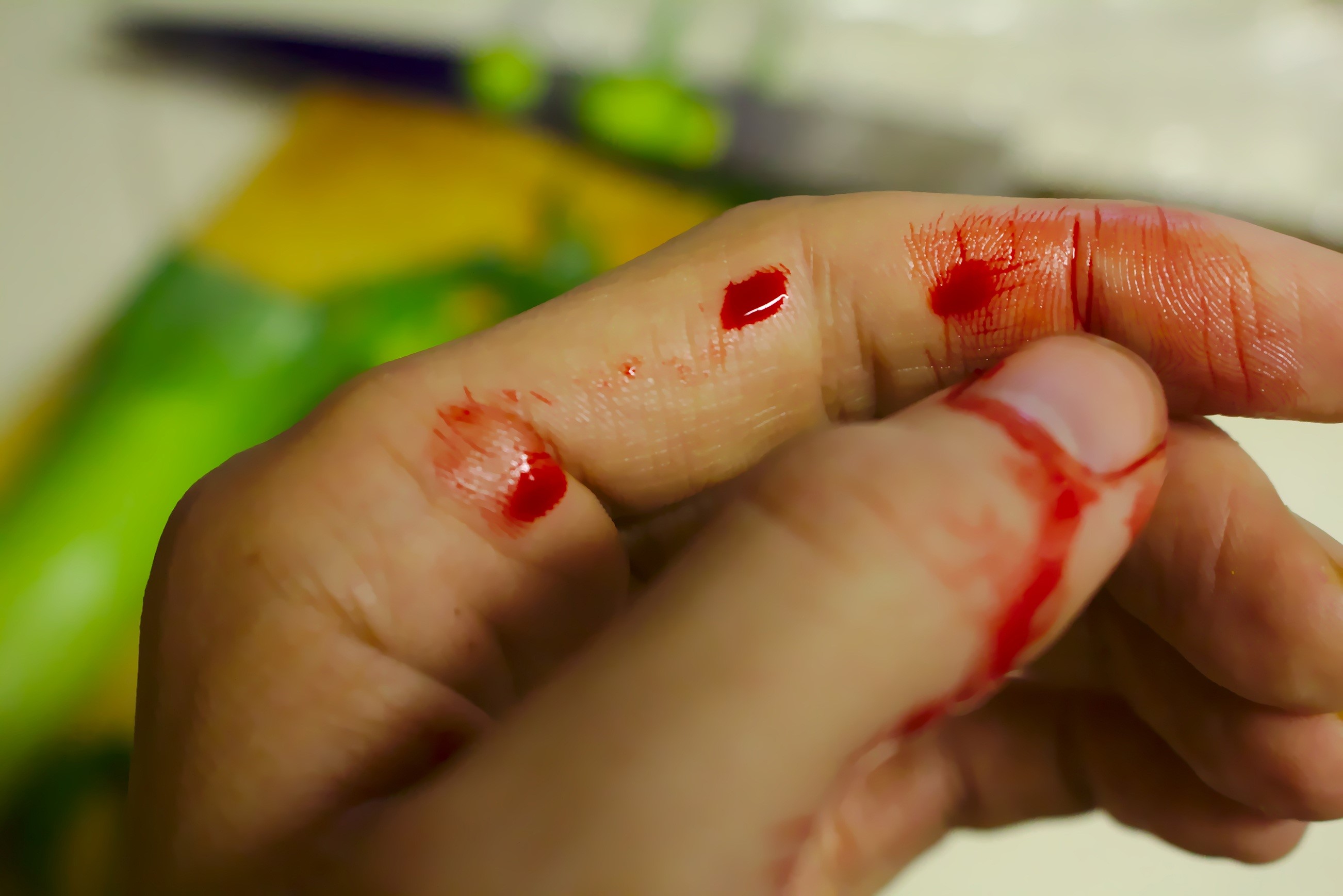 real people, bleed, left, finger, unrecognizable person, slicing, hurt, kitchen, hand, accident, physical injury, human hand, chopping board, medical, chopping, HD Wallpaper