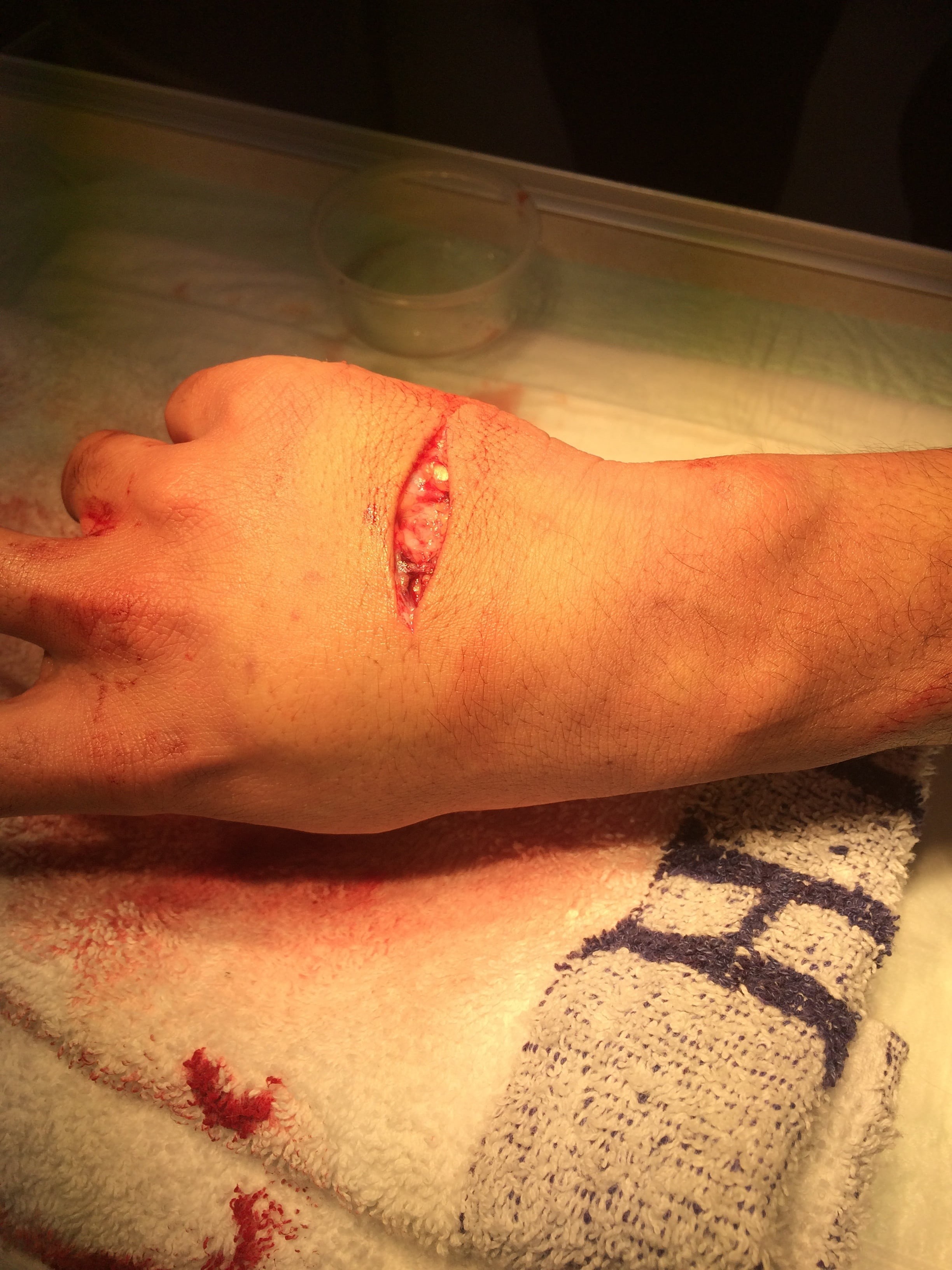 limb, blood, human body part, misfortune, human blood, physical injury, wounding, accident, one person, human limb, human leg, body part, healthcare and medicine, Phone HD Wallpaper