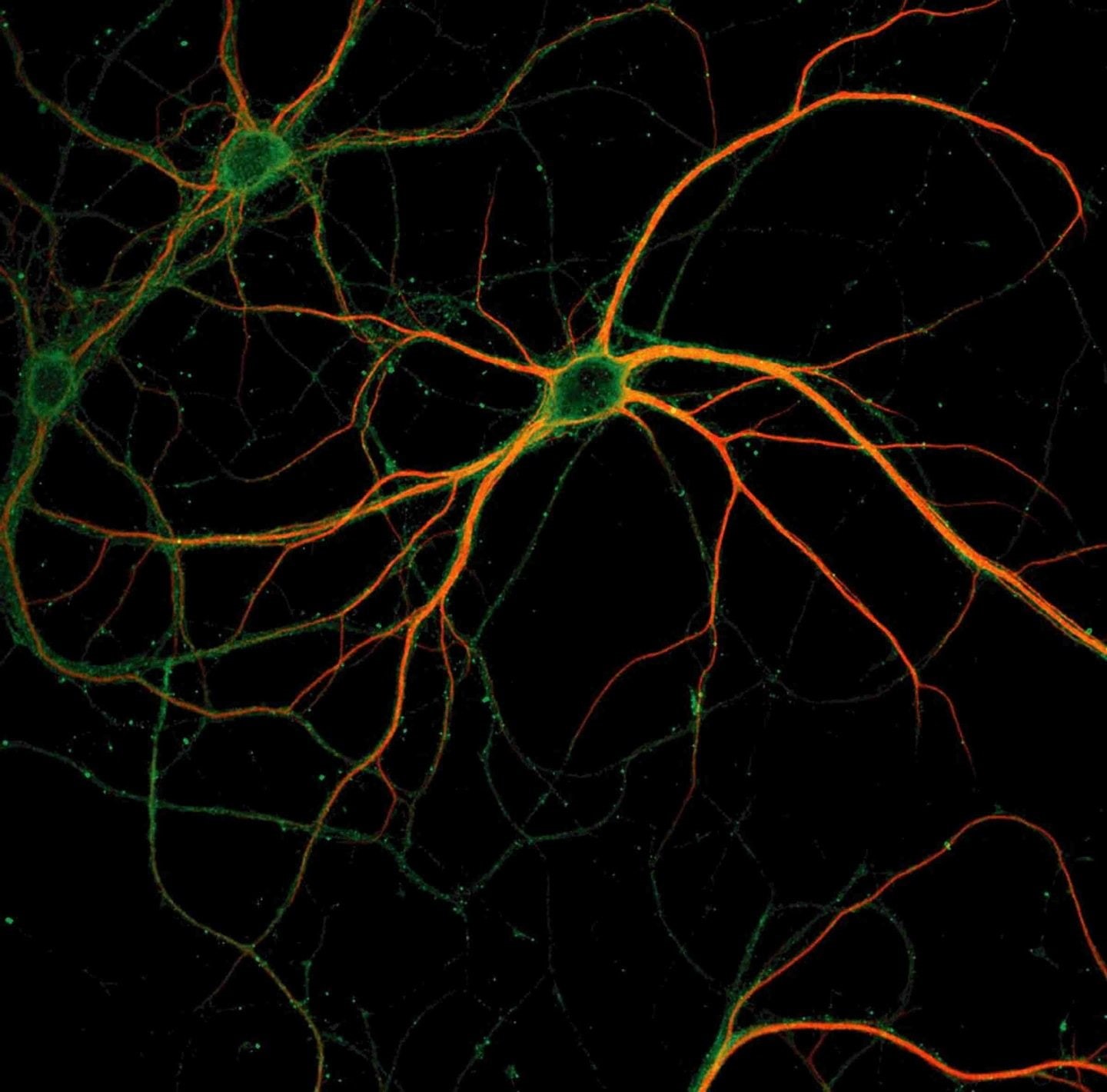 nature, motion, Anatomy, plant, 720P, backgrounds, ray, x, digital, long exposure, astronomy, brain, space, pattern, Medical, glowing, psychedelic, studio shot, HD Wallpaper