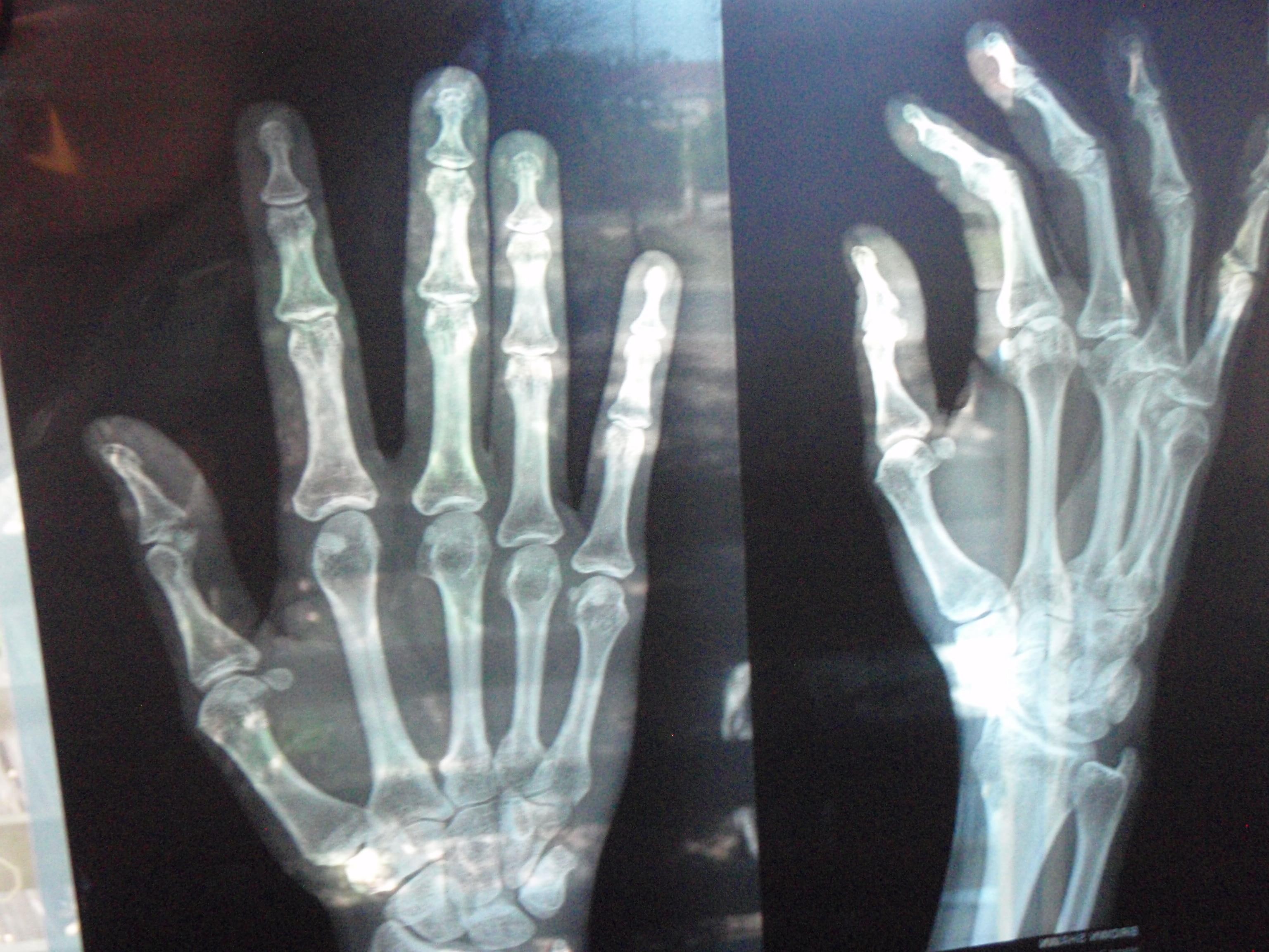 anatomy, ray, hand, bones, doctor, 2K, x, photograpy, x-ray, HD Wallpaper