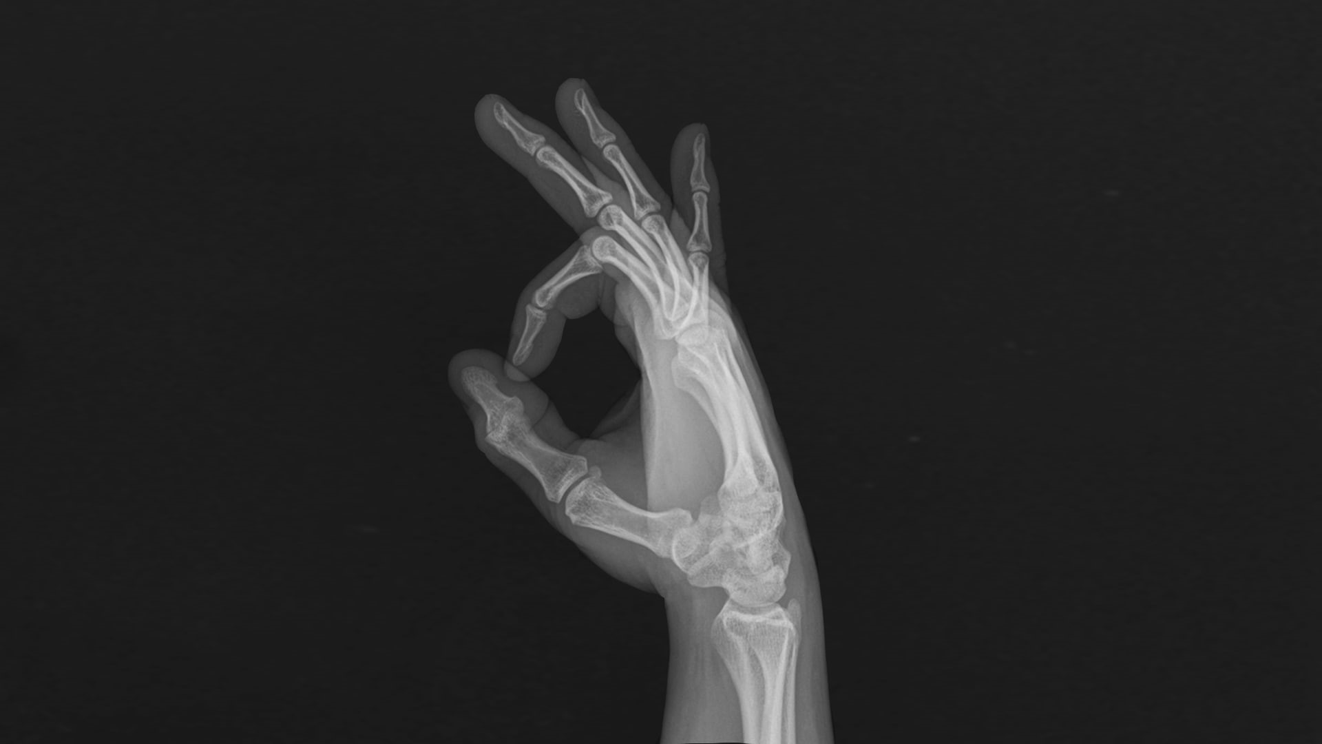hands, 1080P, x-rays, fingers, bones, HD Wallpaper