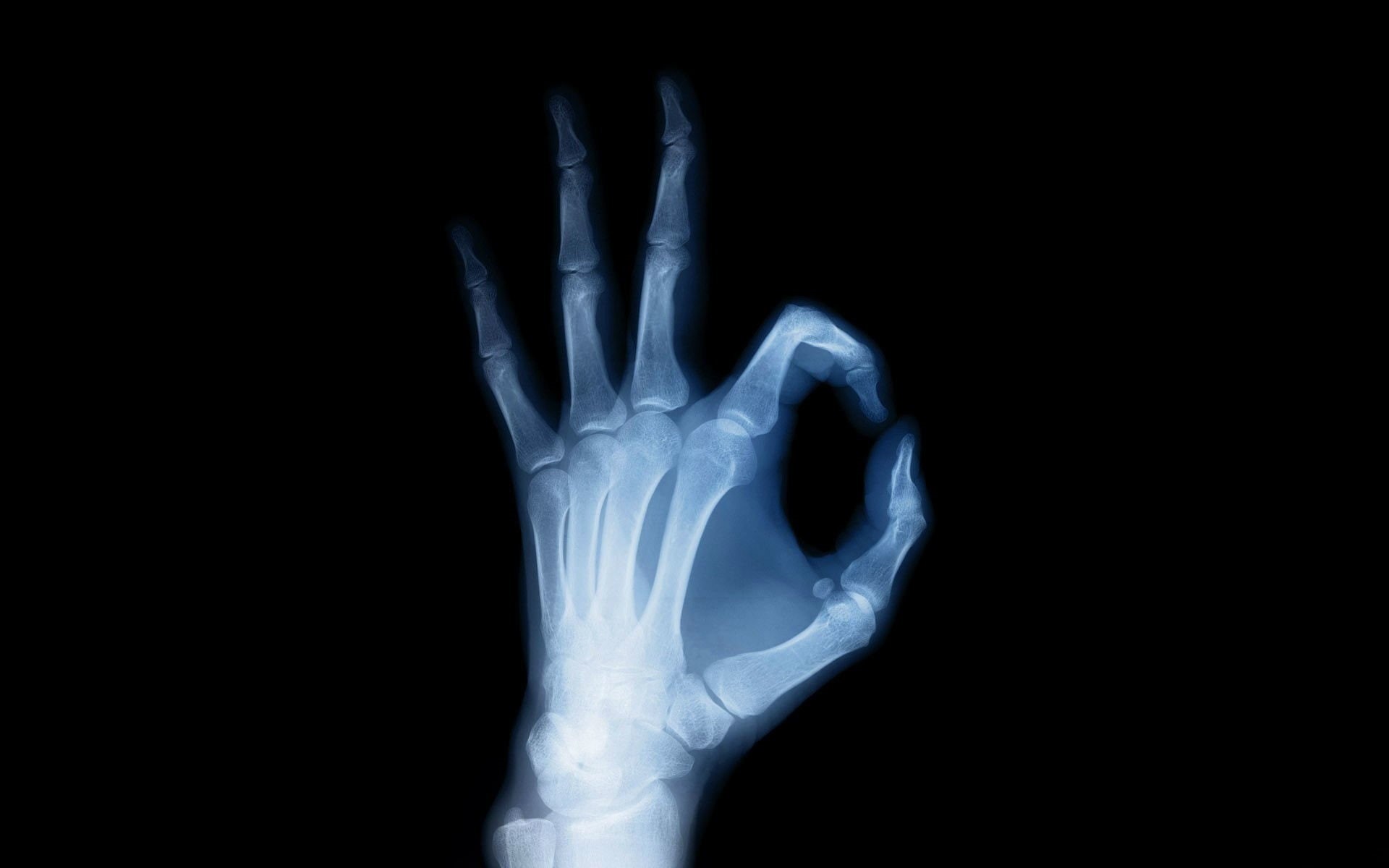 Anatomy, Hand, Photography, X-Ray, 1080P, HD Wallpaper