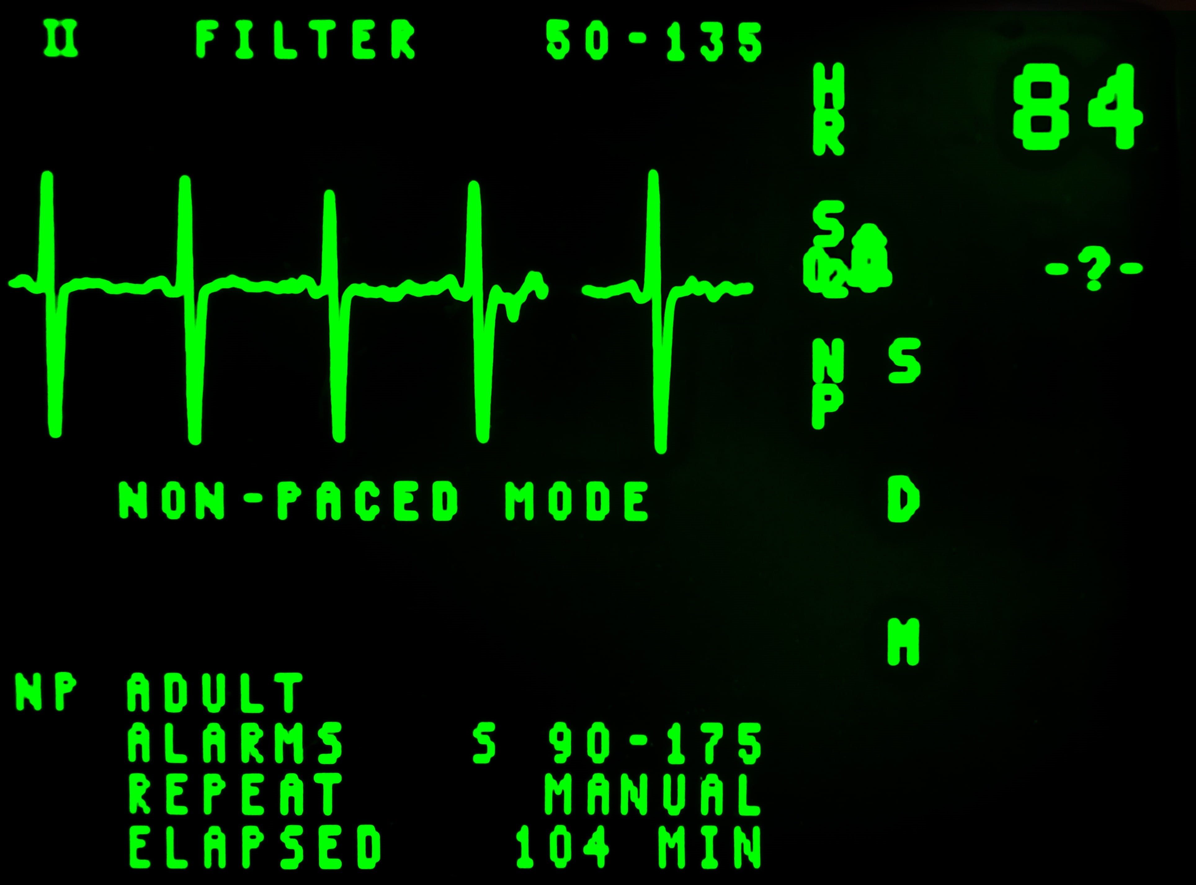 data, beat, close-up, technology, frequency, cardiology, display, control panel, medicine, communication, rate, graph, led, finance, pulse, reading, digital display, HD Wallpaper