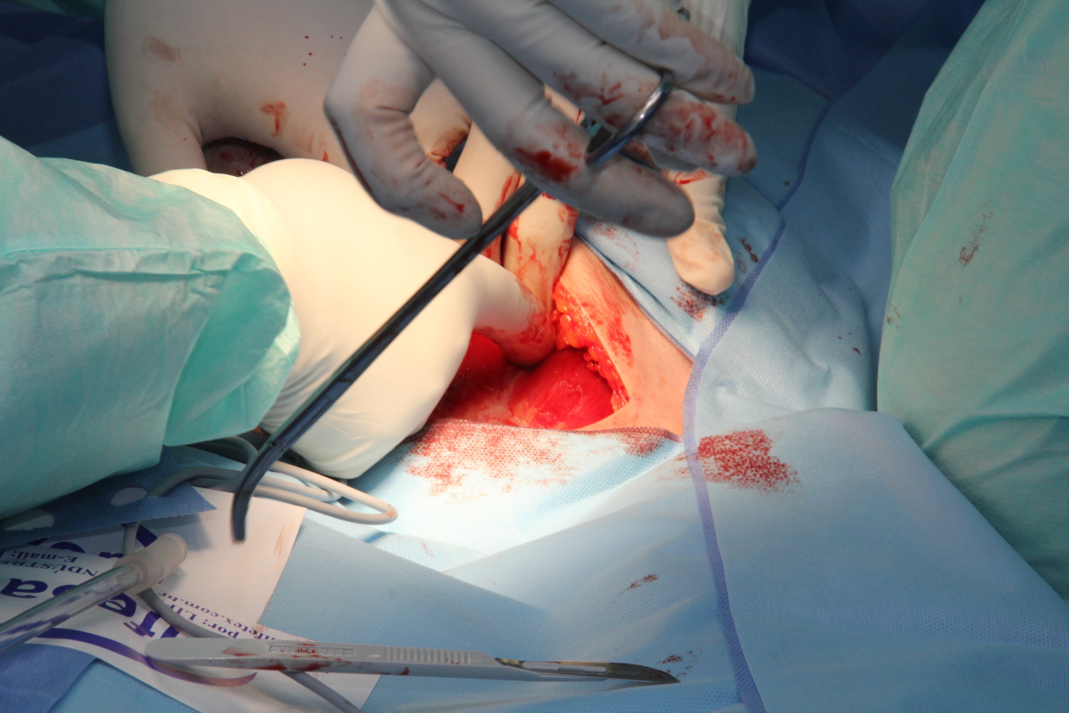indoors, human hand, health, surgical, hospital, patient, birth, expertise, surgeon, care, professional, clinic, procedure, protective glove, medical, 2K, HD Wallpaper