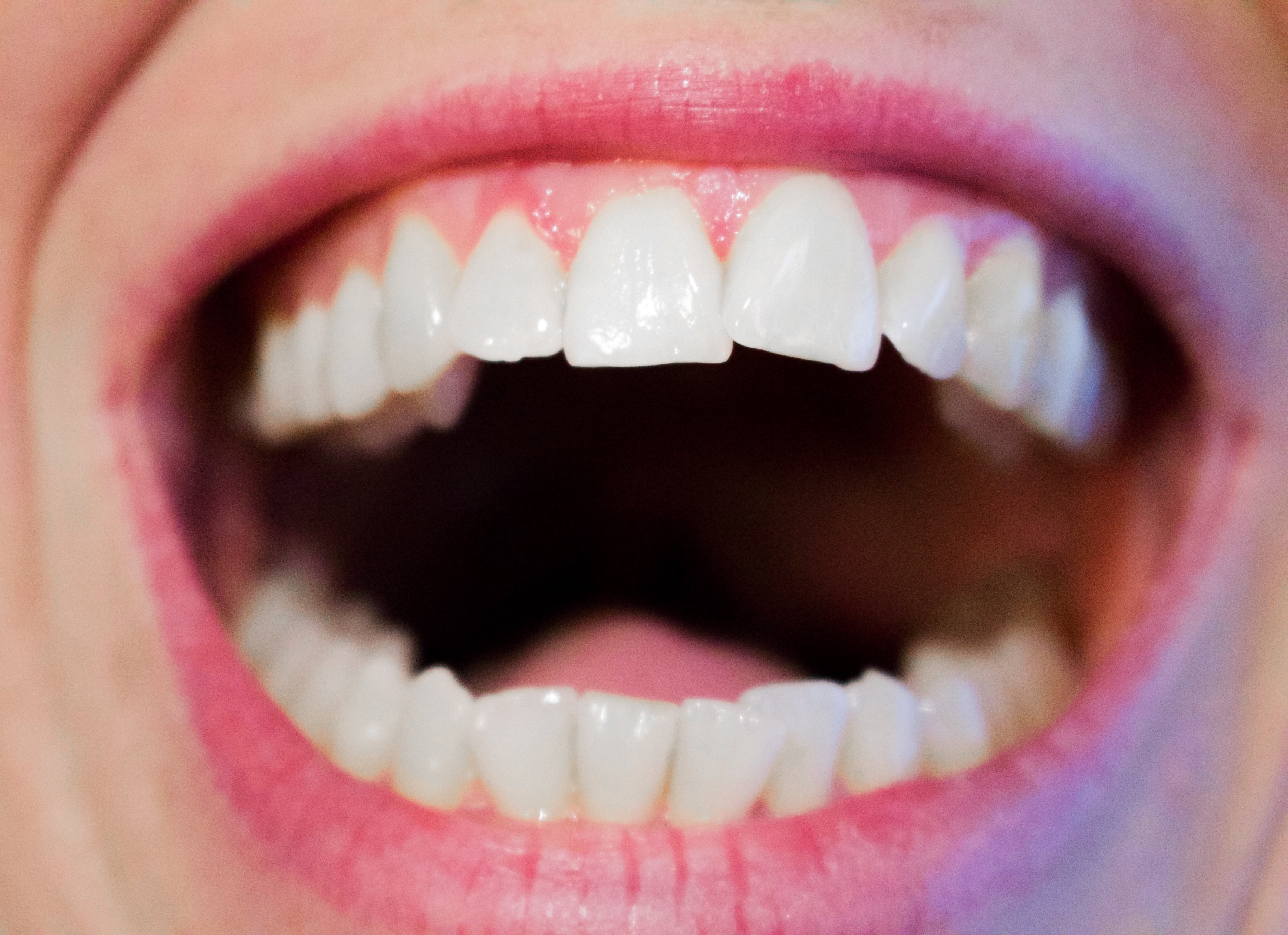 human, 4K, indoors, human Mouth, care, woman, open, jaw, dental, women, human Lips, dentistry, happy, dentist, teeth, mouth open, body part, purple, human face, HD Wallpaper