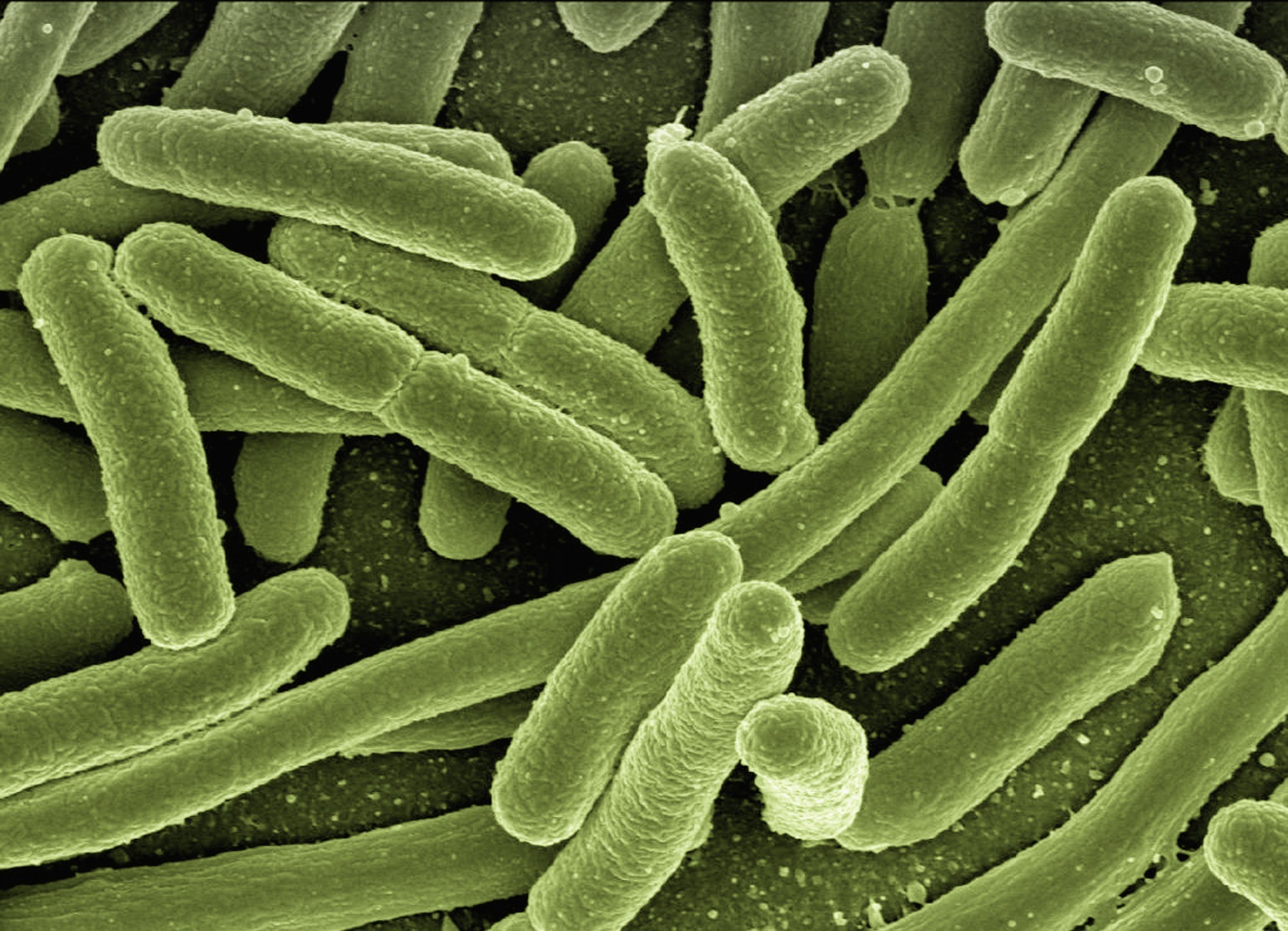 science, close-up, infect, escherichia, water, 1080P, green color, beauty in nature, risk of infection, photography, full frame, invertebrate, technology, HD Wallpaper