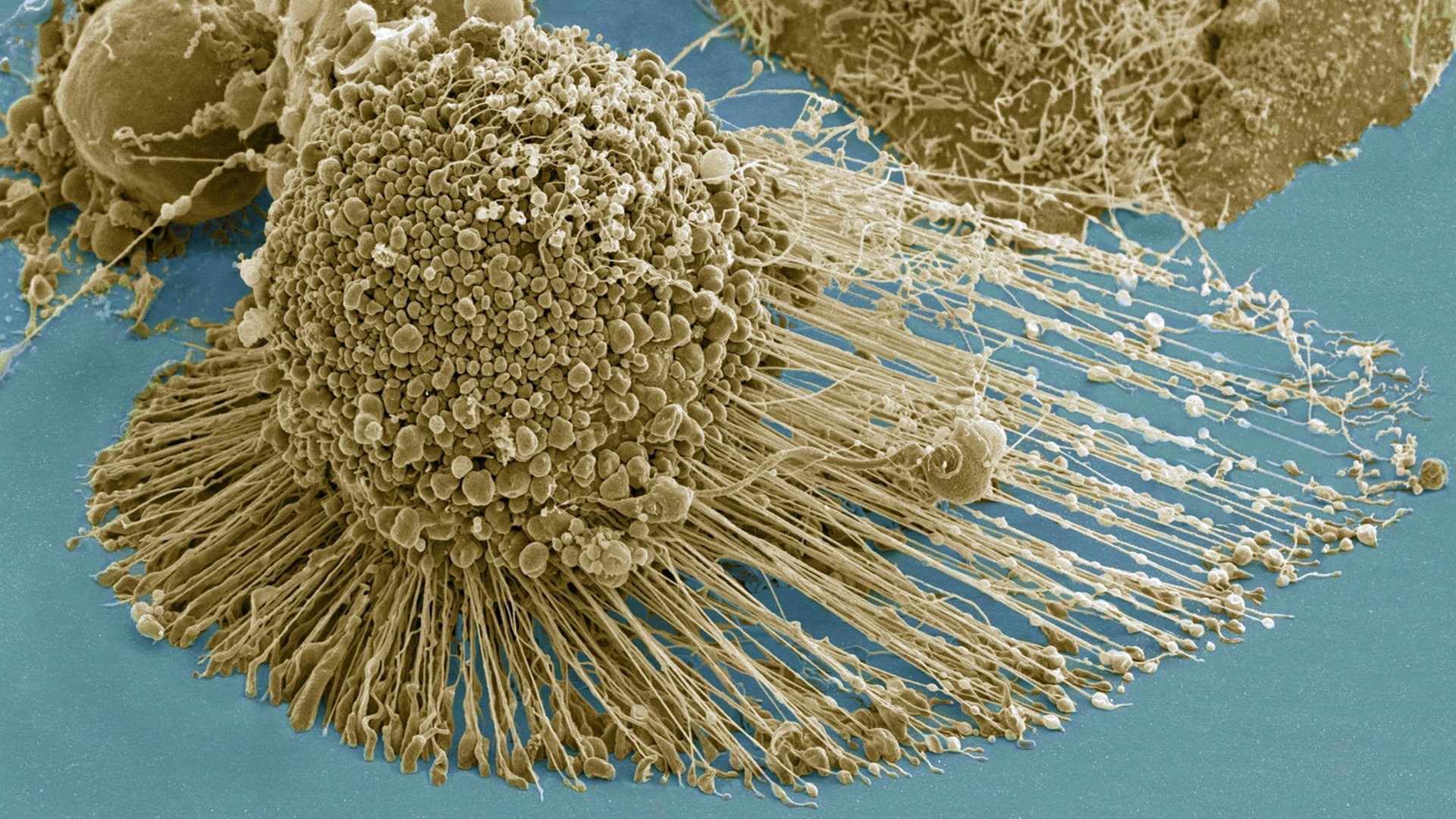 microscopic, cells, 1080P, HD Wallpaper
