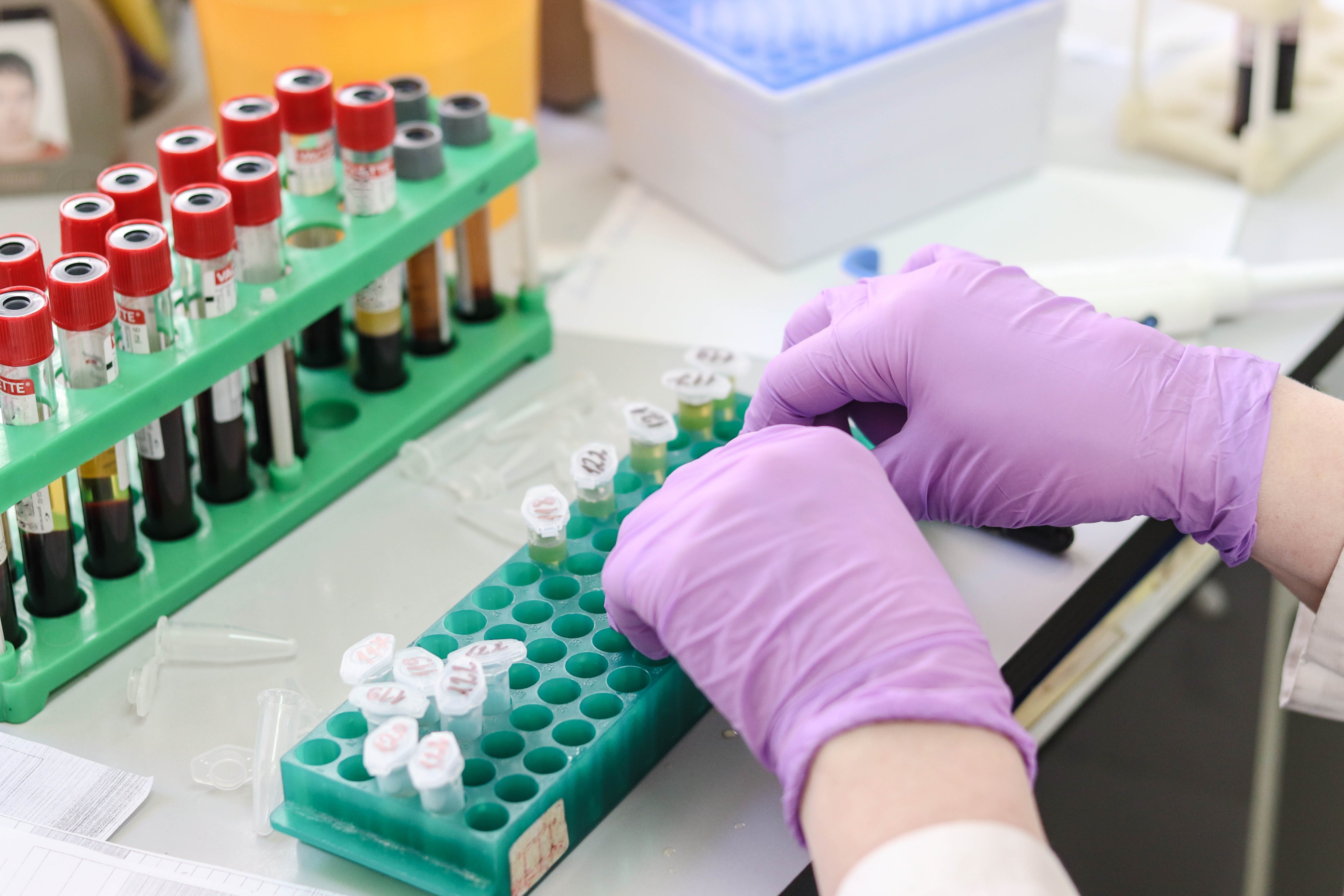medical, human hand, lab, human body part, medical research, indoors, holding, 5K, woman, education, protection, hand, test tube rack, equipment, technology, HD Wallpaper