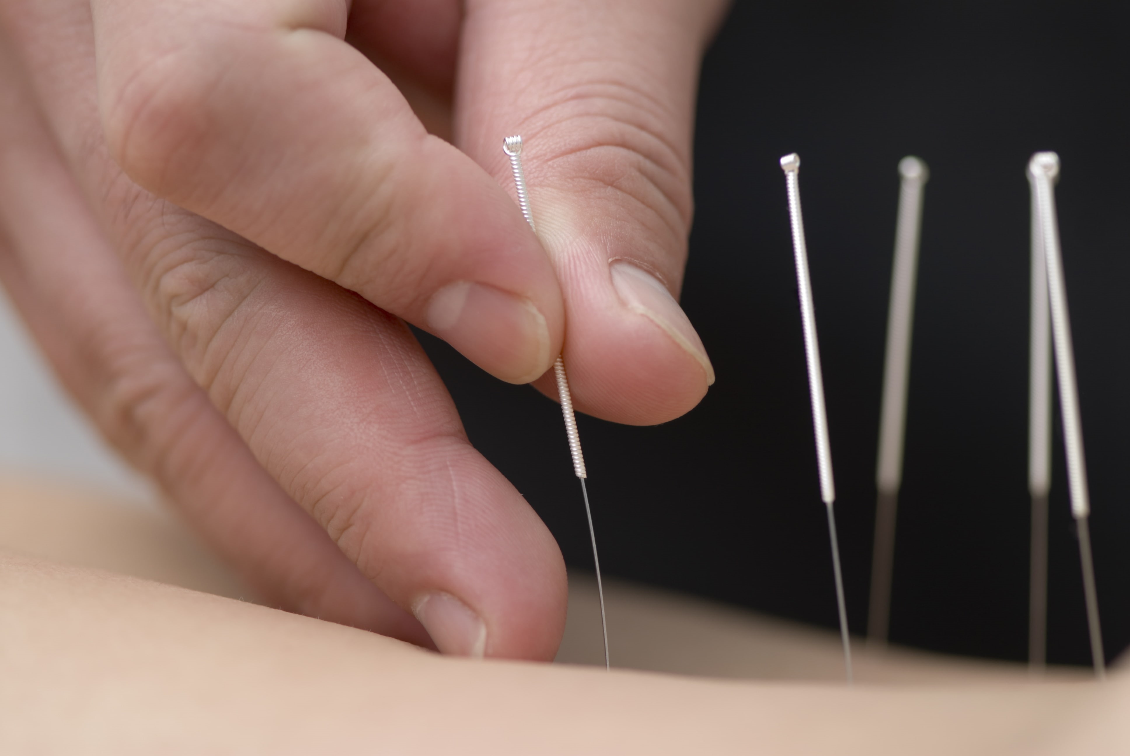 hands, skin, 4K, fingers, needles, acupuncture, HD Wallpaper