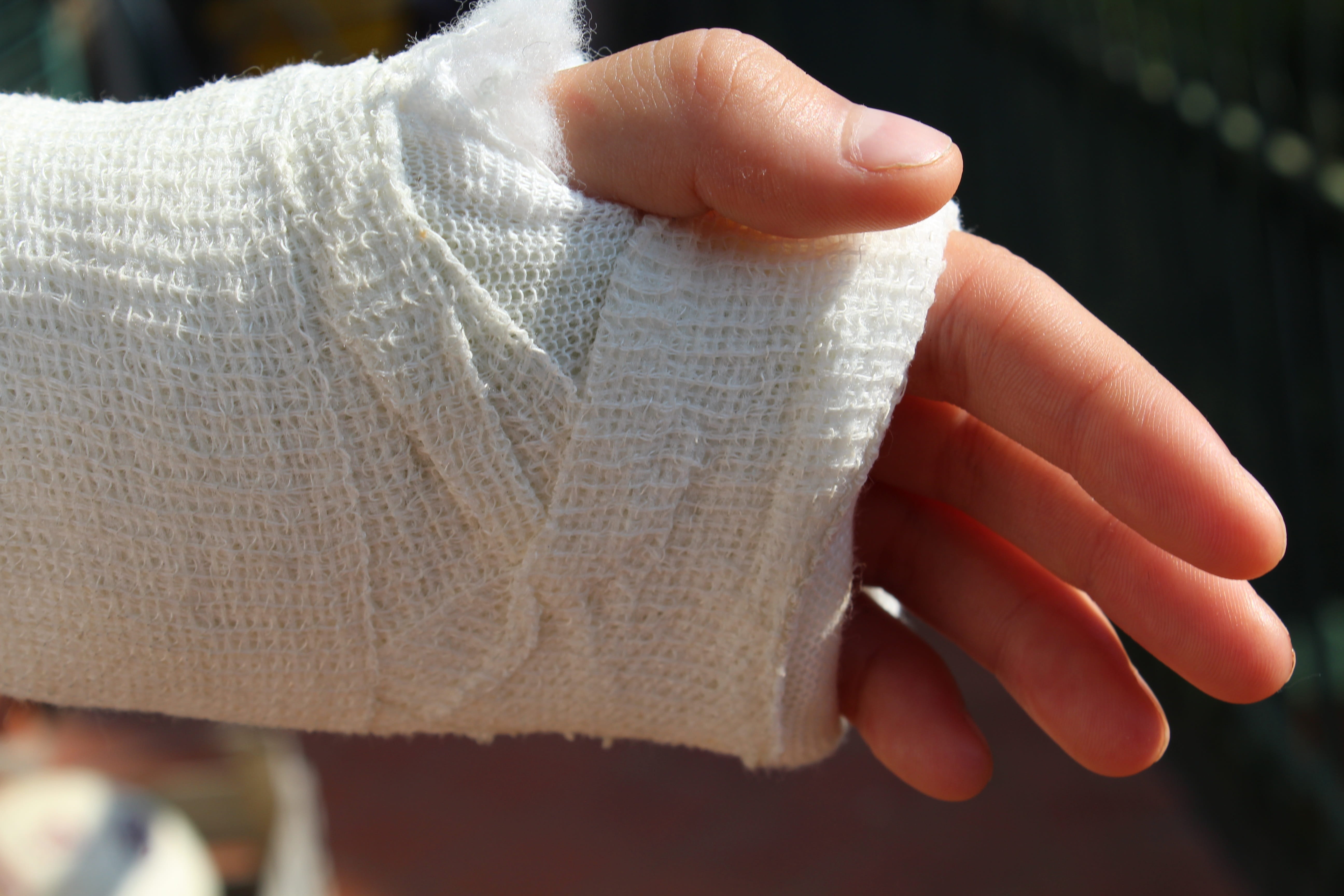 broken, sprained, medicine, leisure activity, men, human body part, textile, clothing, 5K, hand, wool, pain, body part, bandage, injury, bandages, focus on foreground, HD Wallpaper