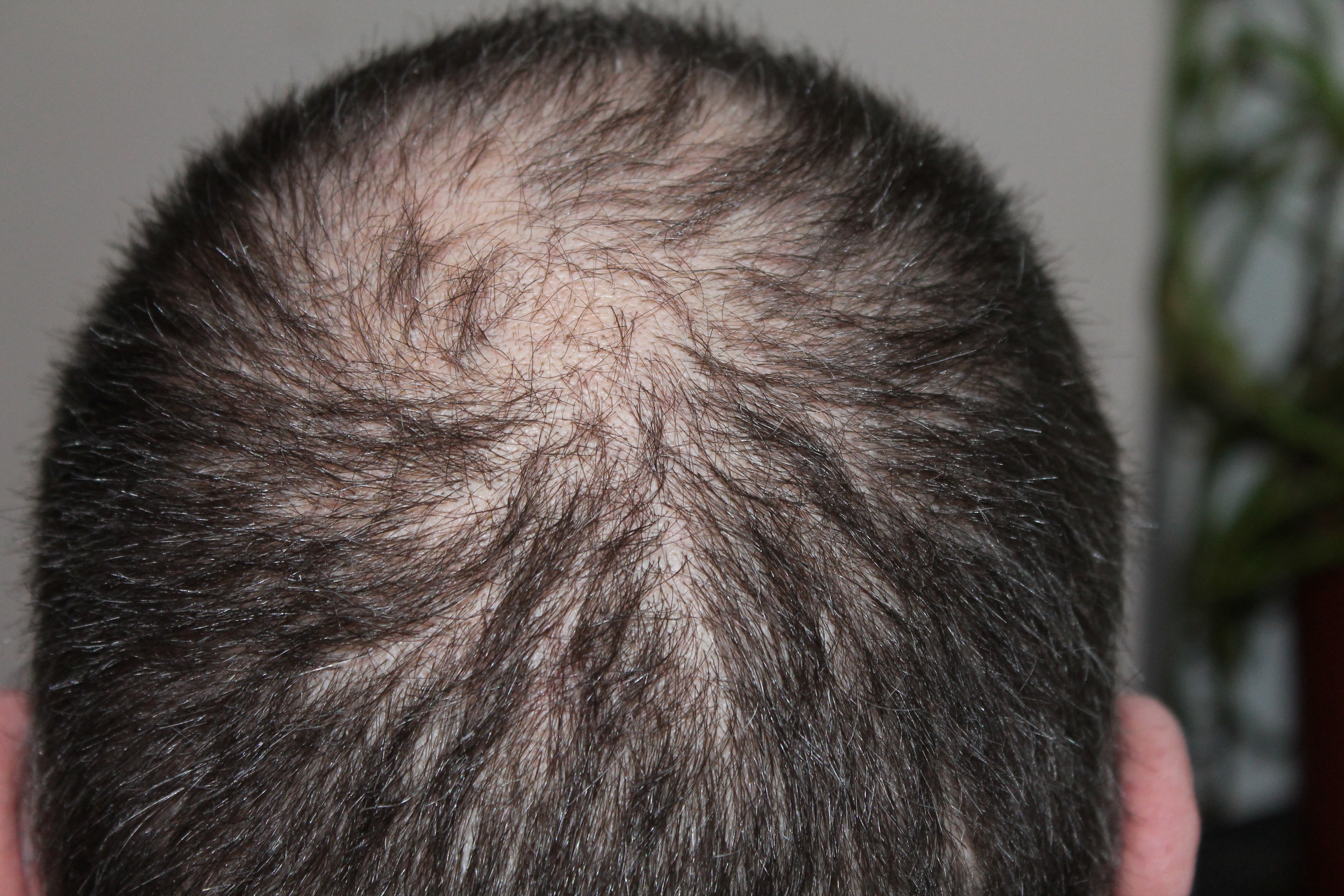 focus on foreground, mammal, body part, man, black, hair loss, animal body part, head, people, animal hair, men, domestic, domestic animals, vertebrate, HD Wallpaper