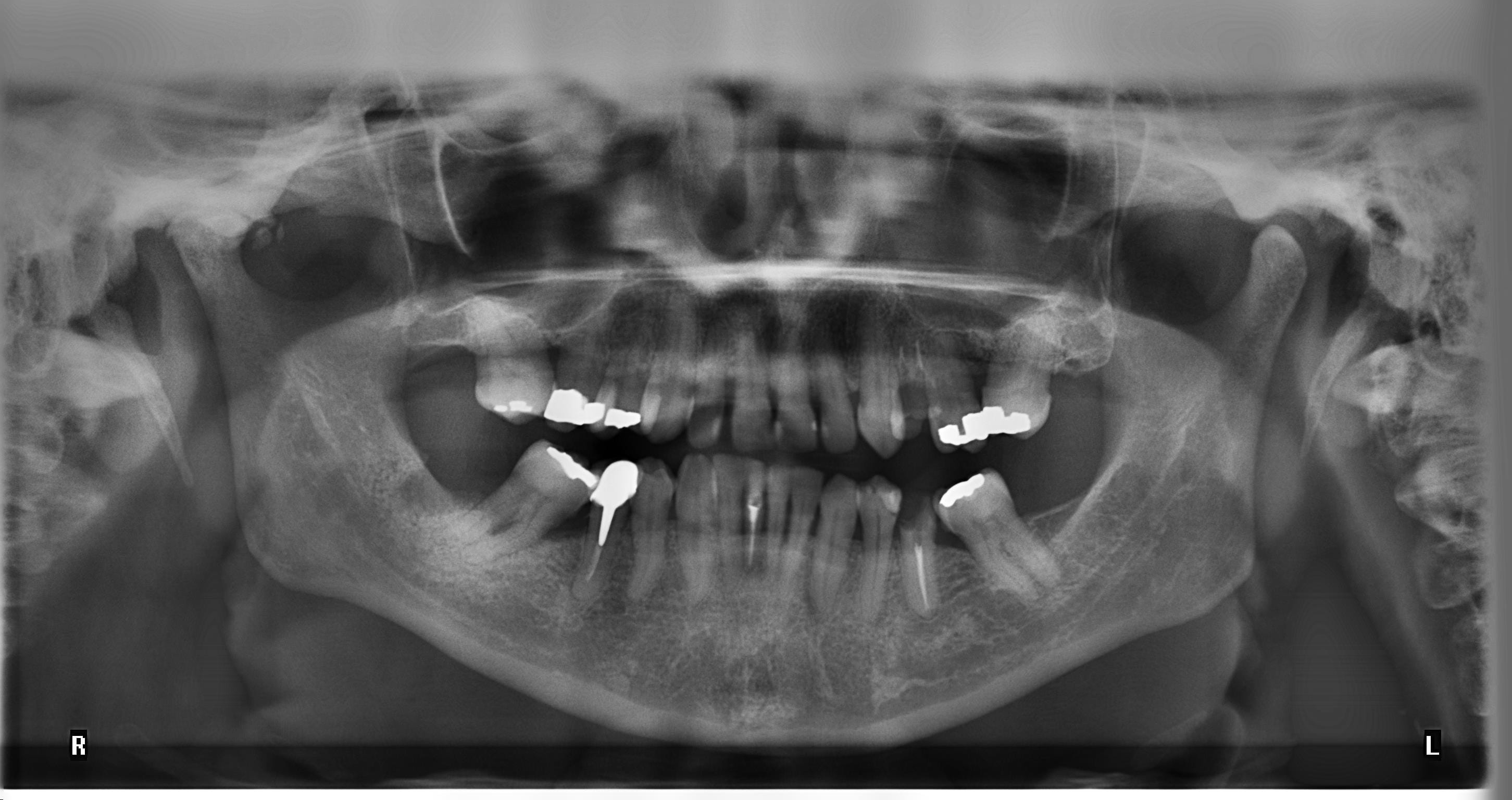 tooth, communication, human face, jaw, emotion, 2K, animal body part, ugly, animal teeth, portrait, human teeth, adult, x-ray, animal mouth, body part, HD Wallpaper