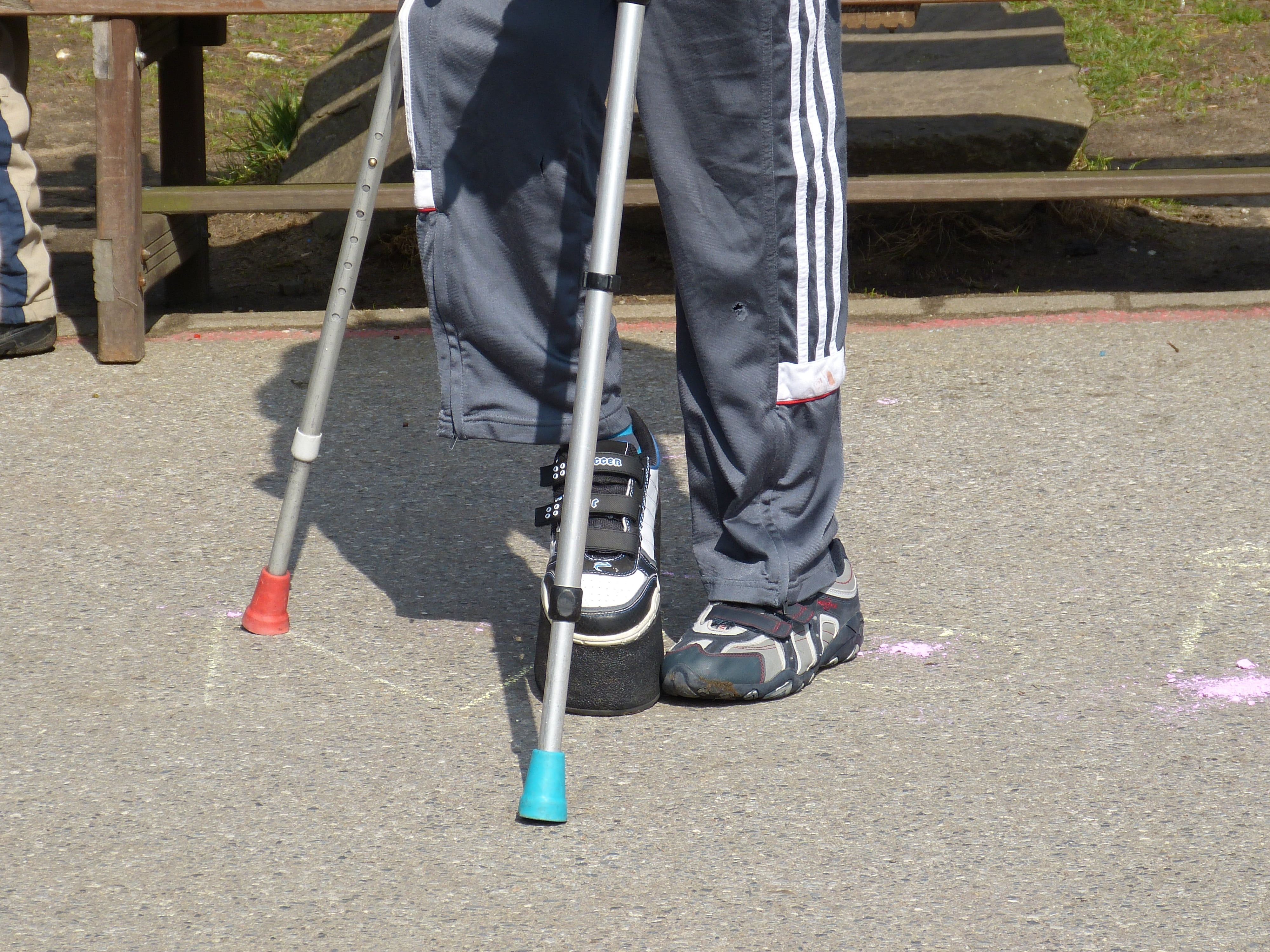 human leg, day, crutch, shadow, human limb, body part, using, forearm, physical impairment, person, handicap, human body part, sunlight, real people, 4K, HD Wallpaper