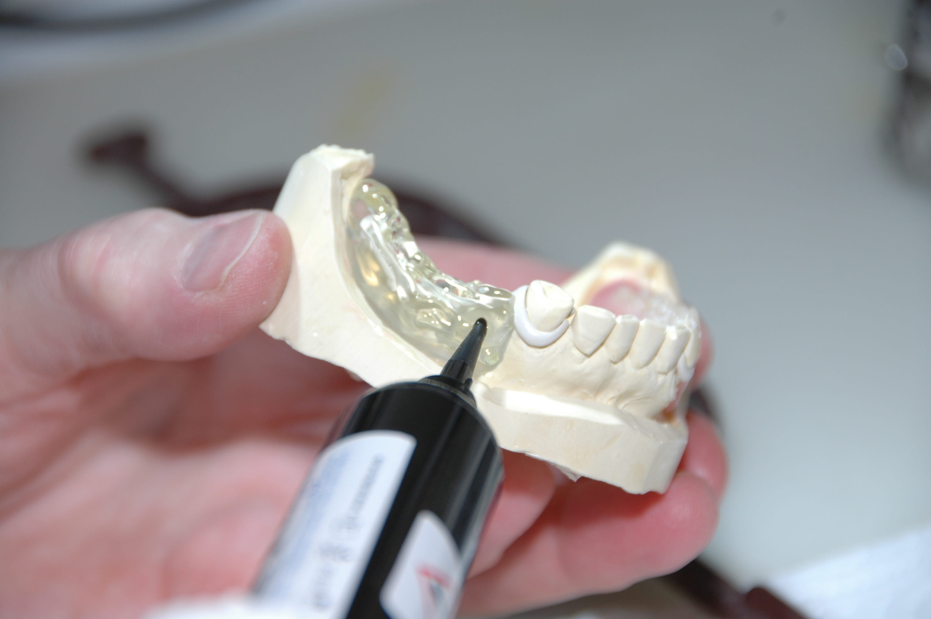 healthcare and medicine, human teeth, person, teeth, dental health, dental equipment, plastic, mold, luxury, hygiene, zahntechnik, hand, human finger, model, HD Wallpaper