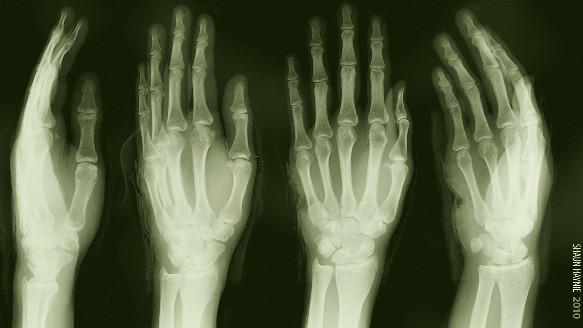 1080P, bones, Hand, X-Ray, human, illustration, Medical, Dark, Skeleton, Green, HD Wallpaper