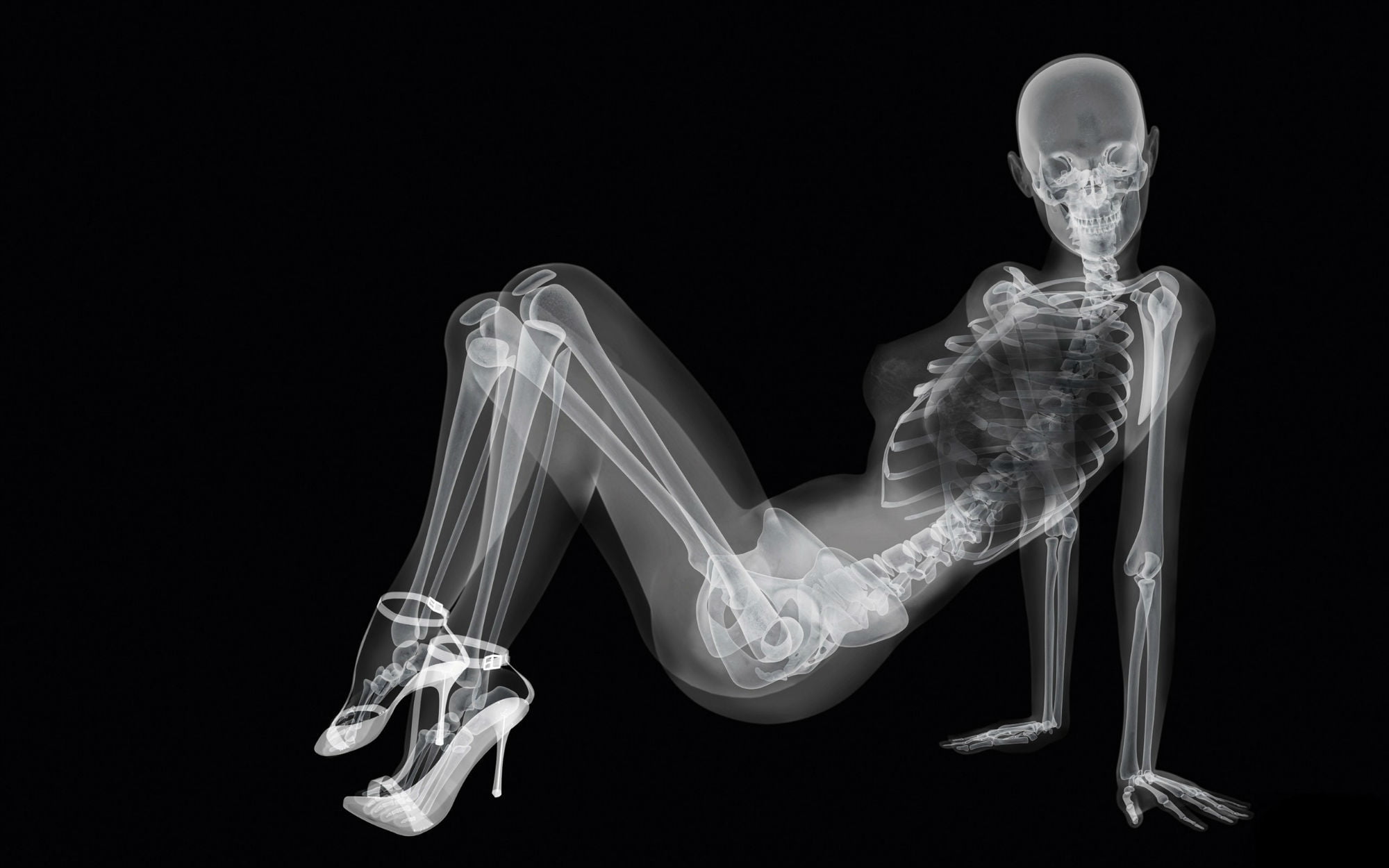 1080P, human Leg, ray, creativity, bone, healthcare And Medicine, representation, illuminated, no people, x-ray Image, black Background, design, digital composite, HD Wallpaper