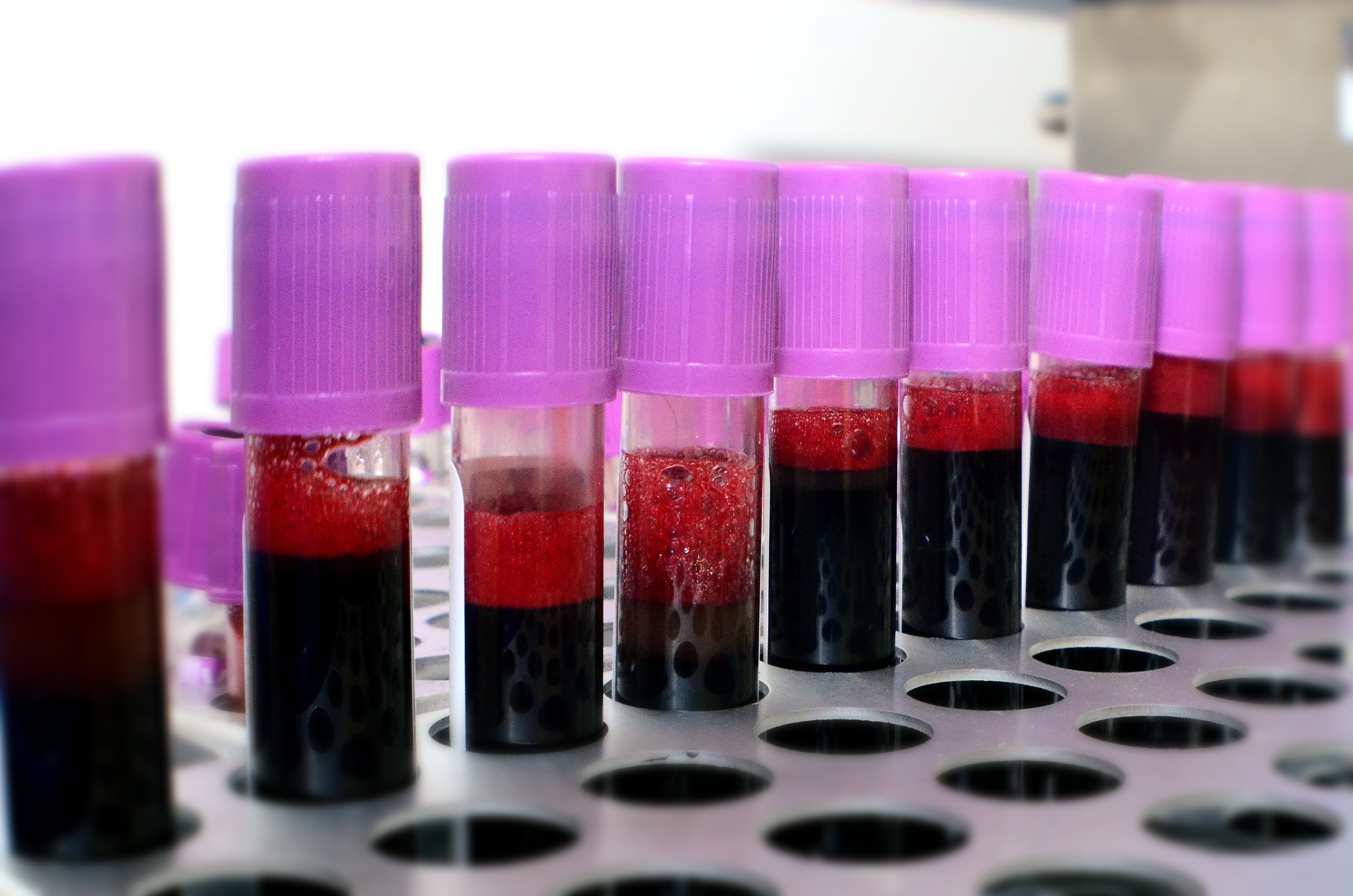 no people, glass - material, in a row, laboratory, indoors, healthcare and medicine, scientific experiment, science, 4K, choice, test tube, purple, multi colored, HD Wallpaper