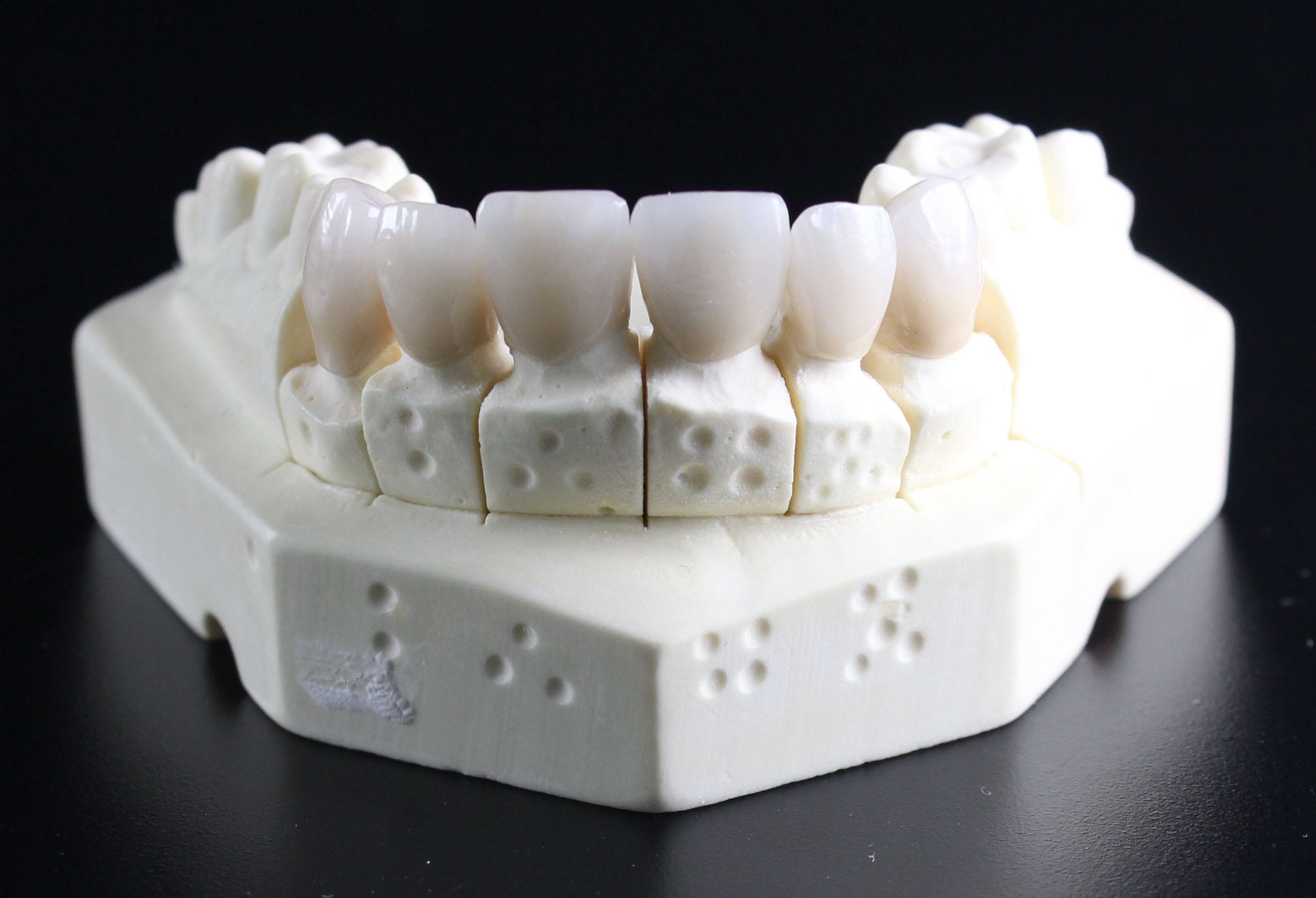 unhealthy eating, studio shot, healthcare and medicine, tooth, dentist, laboratory, close-up, cake, top, white, black background, denture, no people, food, HD Wallpaper