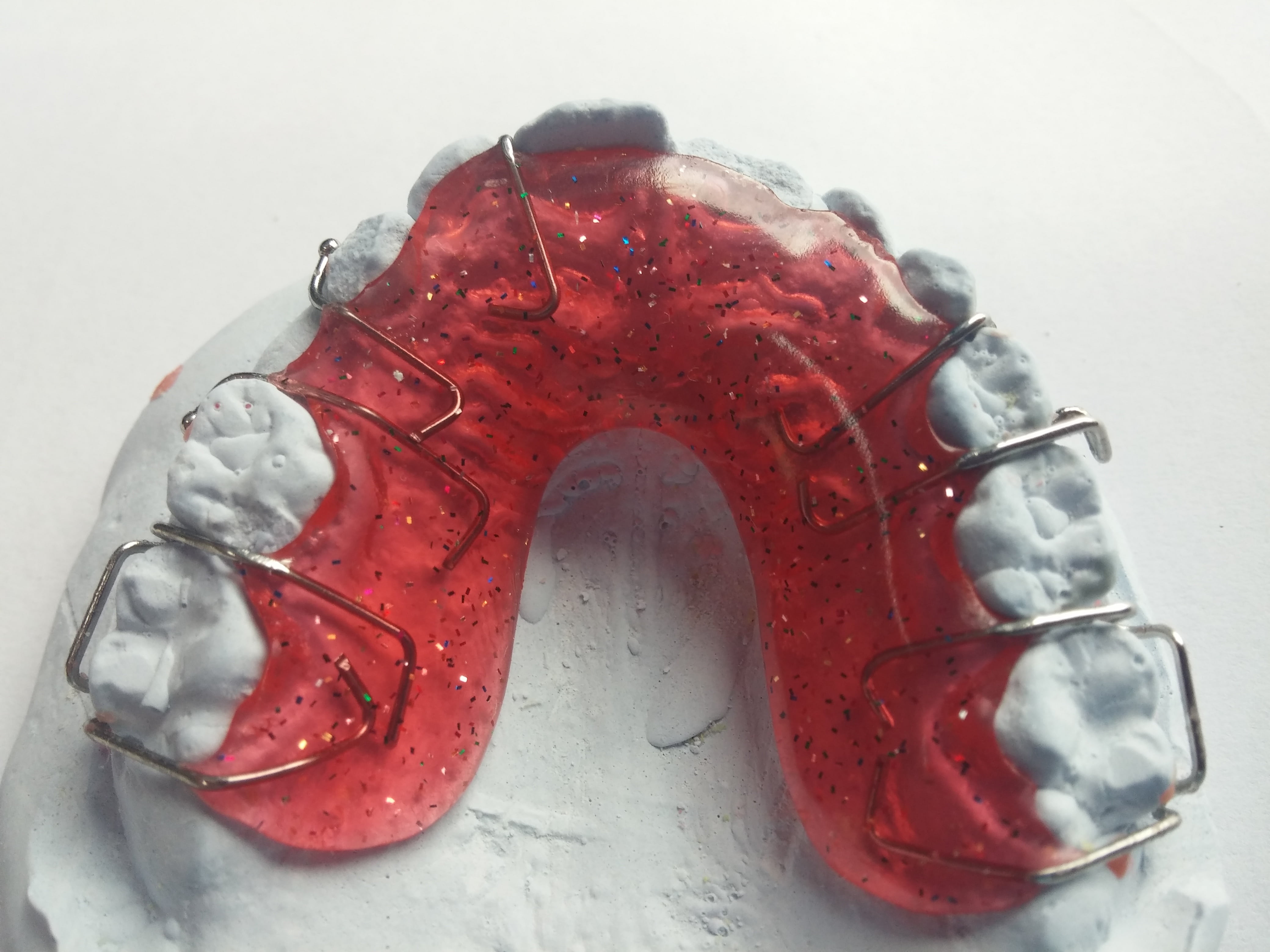 healthy eating, seemed, orthodontic, mold, head, red, no people, freshness, close, cold temperature, studio shot, tooth, single object, dental braces, bite, HD Wallpaper