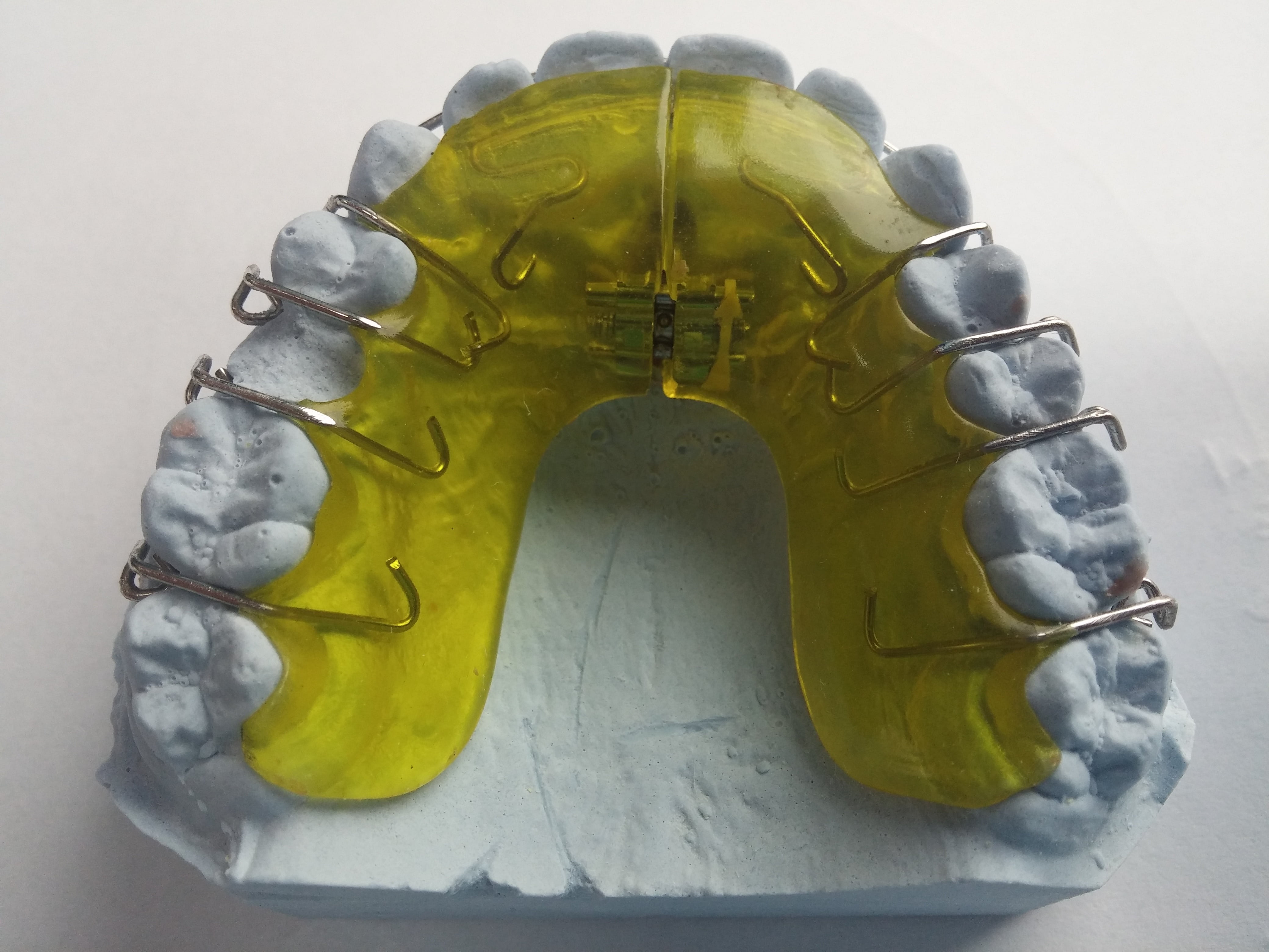 close-up, security, still life, teeth, creativity, mouth, tooth, table, yellow, dentist, the past, close, history, studio shot, seemed, human representation, HD Wallpaper