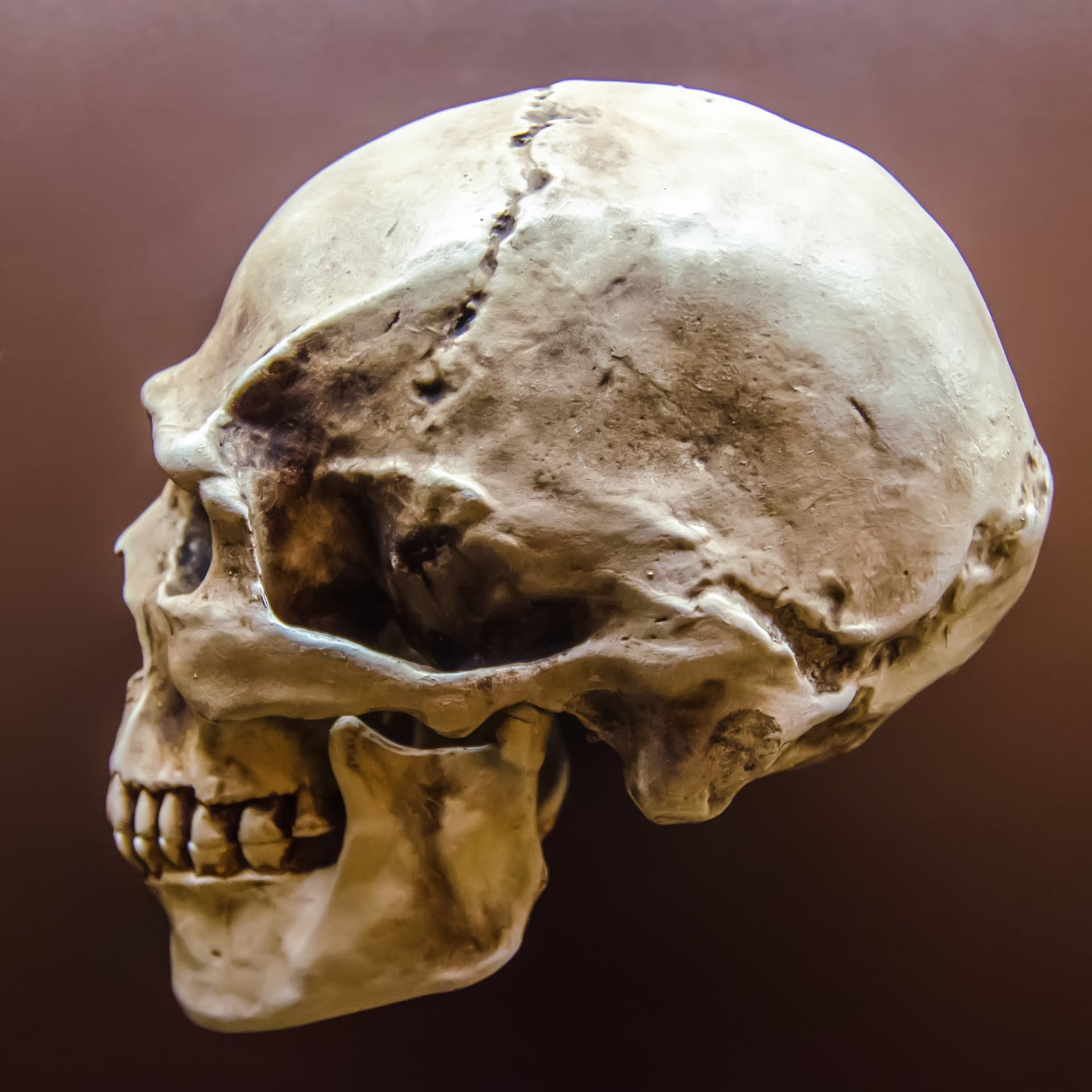 fallen, brain, gone, skull, photo, indoors, head, heal, human skull, bone, anatomy, halloween, dead, grim reaper, death, death metal, studio shot, body part, Phone HD Wallpaper