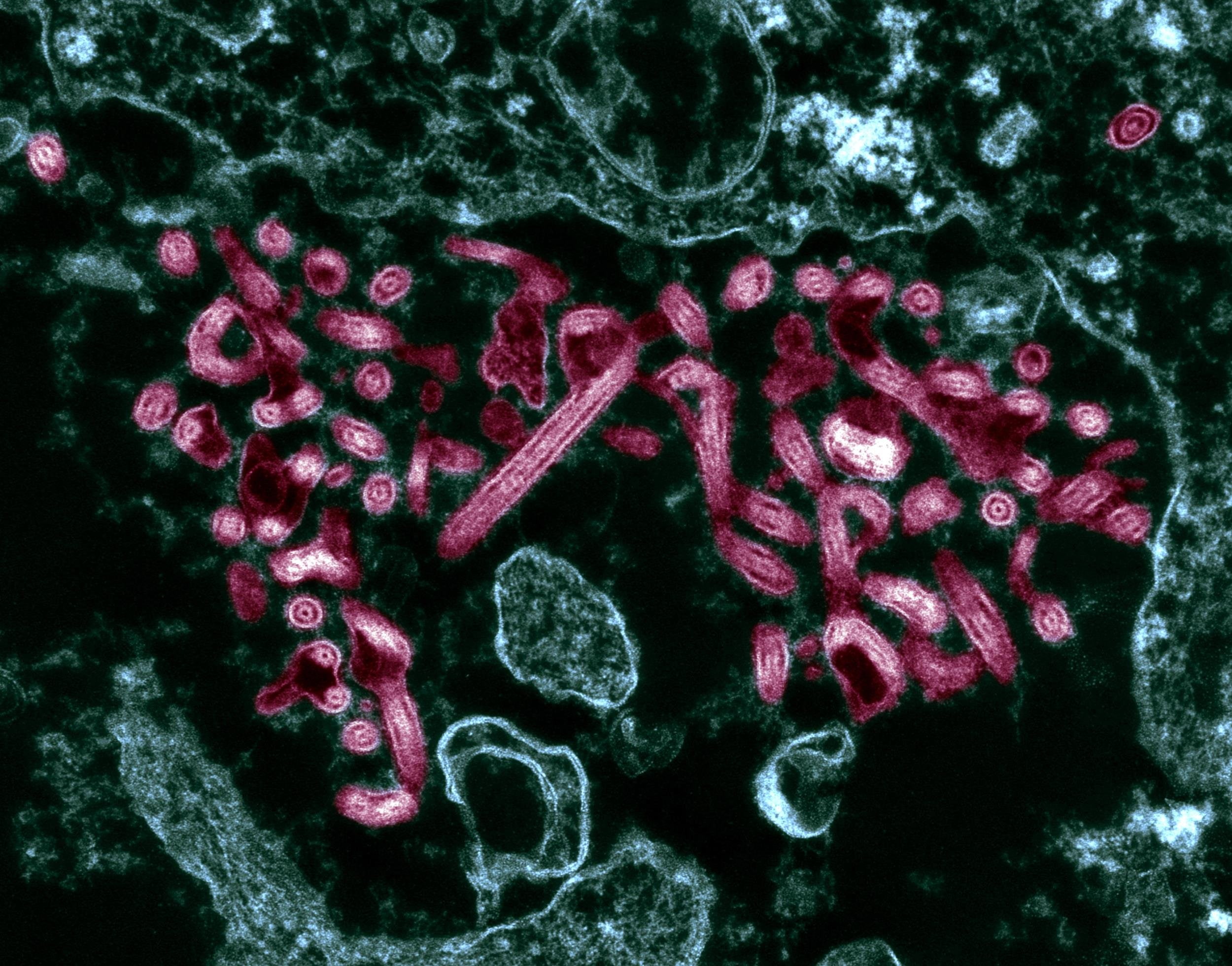 dark, ebola, 1080P, horror, virus, medical, HD Wallpaper