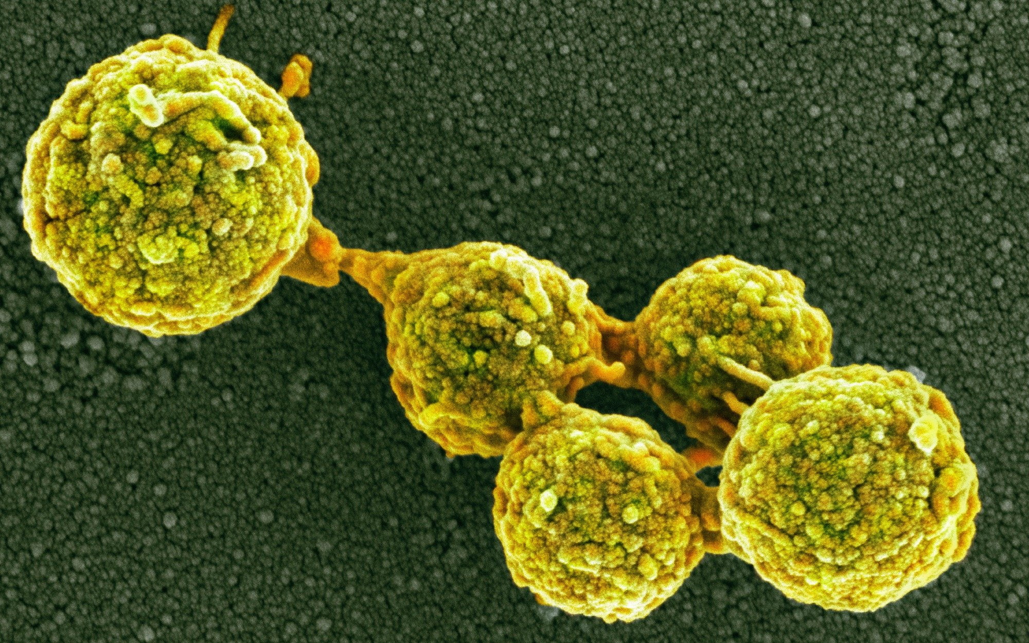 Medical, Disease, Virus, flu, 1080P, HD Wallpaper