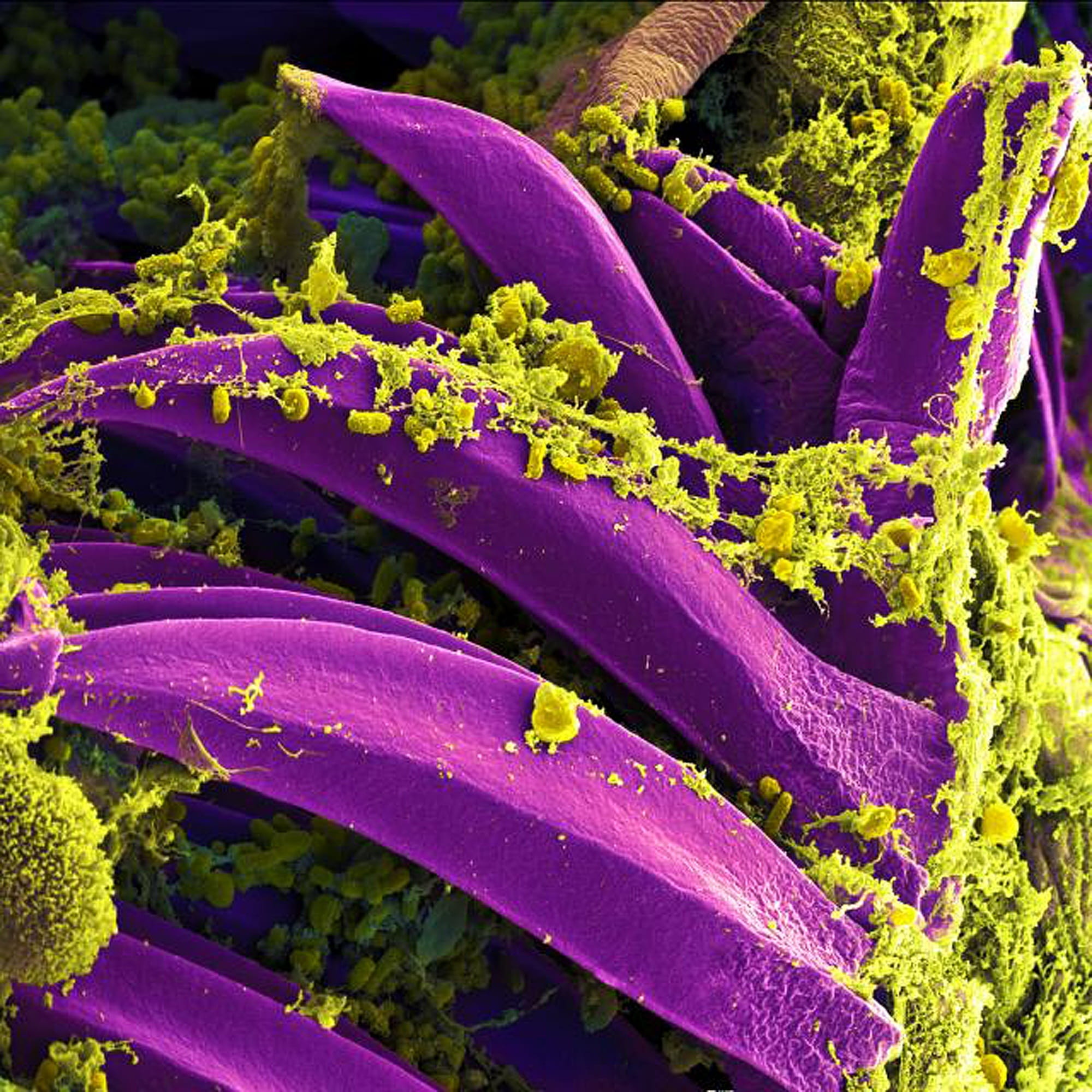 electron microscope, close-up, food and drink, y pestis, freshness, plant, purple, macro, no people, green color, science, beauty in nature, organism, epidemic, Phone HD Wallpaper