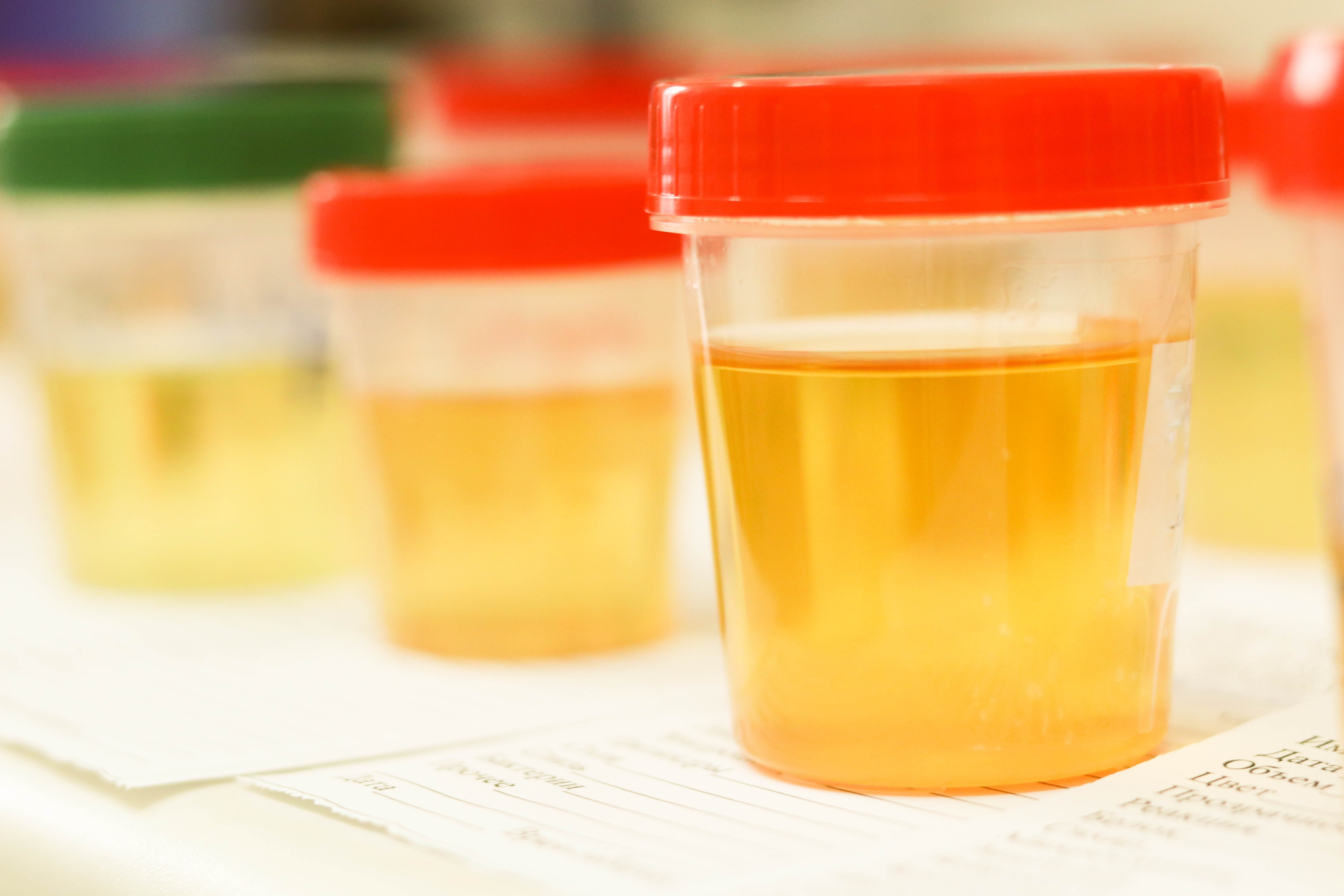 blood samples, small group of objects, drinking glass, tube, refreshment, orange color, 5K, scientist, hospital, household equipment, laboratory, tray, HD Wallpaper