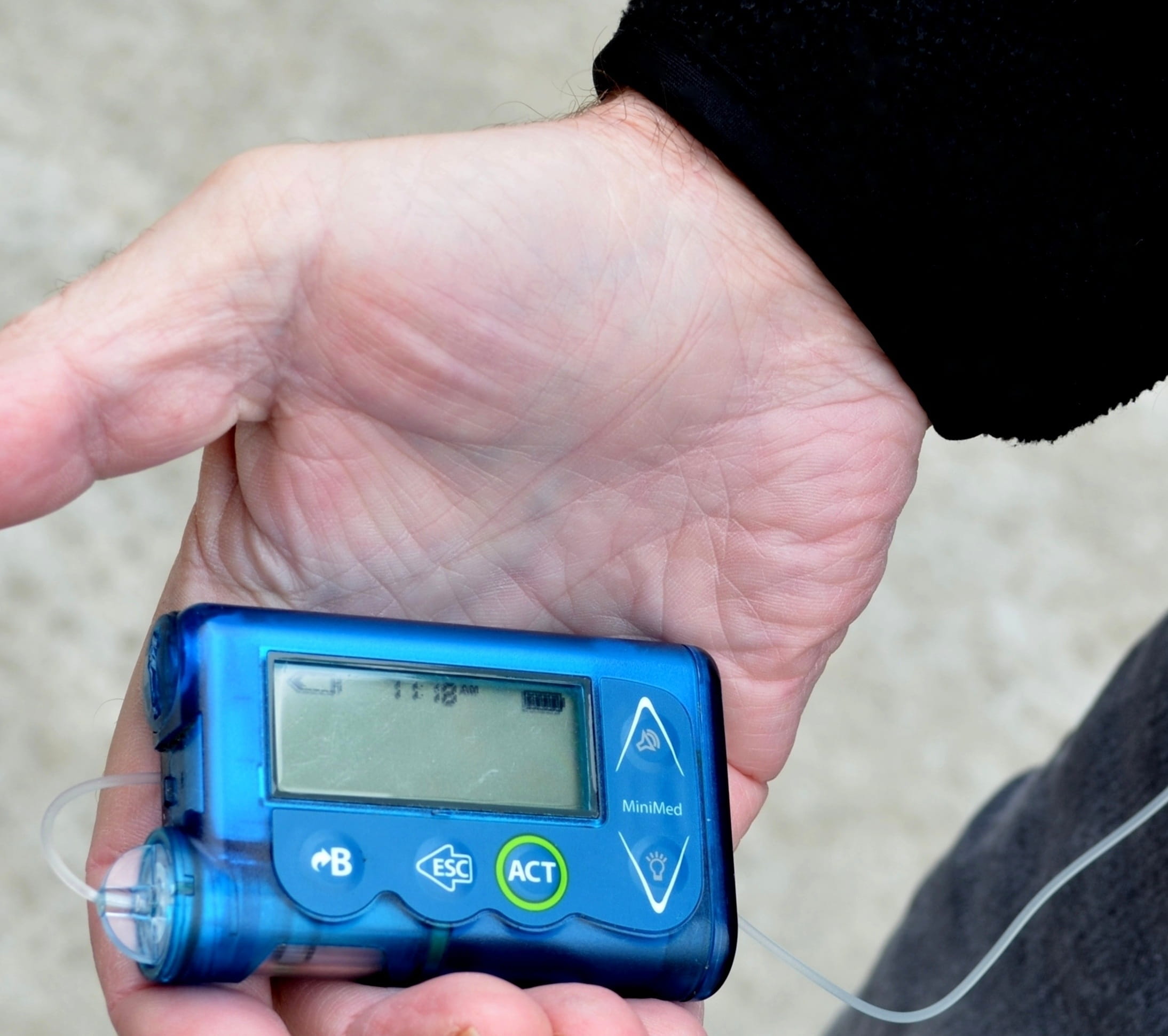 glucose, treatment, leisure activity, medicine, day, men, healthcare, focus on foreground, sickness, control, insulin, Insulin, care, lifestyles, holding, HD Wallpaper