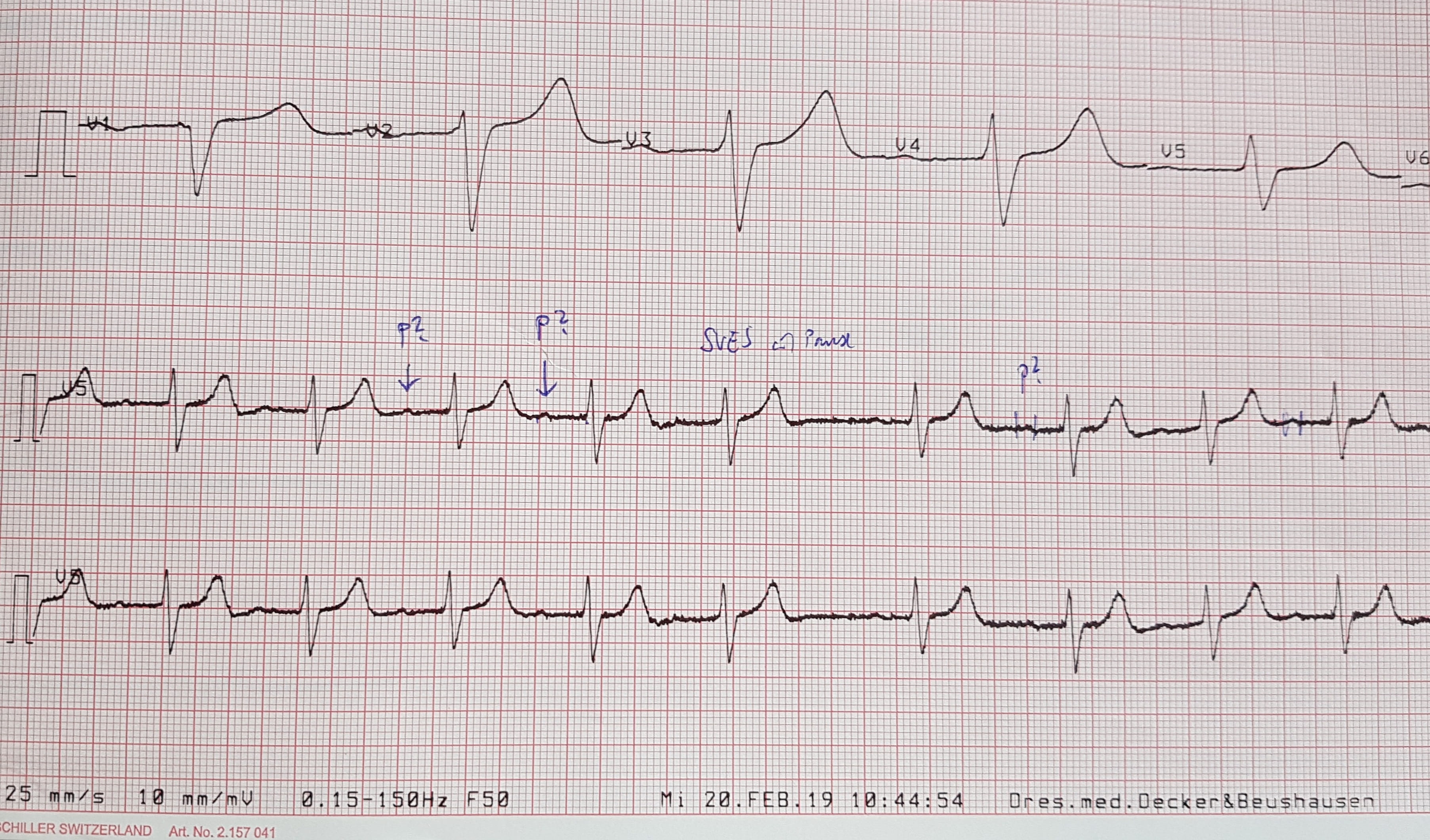 heart, ecg, western script, doctors office, instrument of measurement, close-up, document, pattern, text, message, 2K, communication, healthcare and medicine, HD Wallpaper