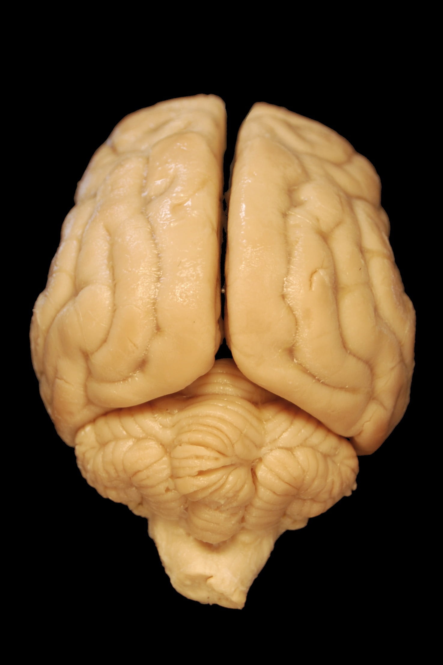 surface, human Brain, Dog, single object, human body part, black, human finger, finger, indoors, veterinary medicine, cerebrum, studio shot, model, cerebellum, Phone HD Wallpaper