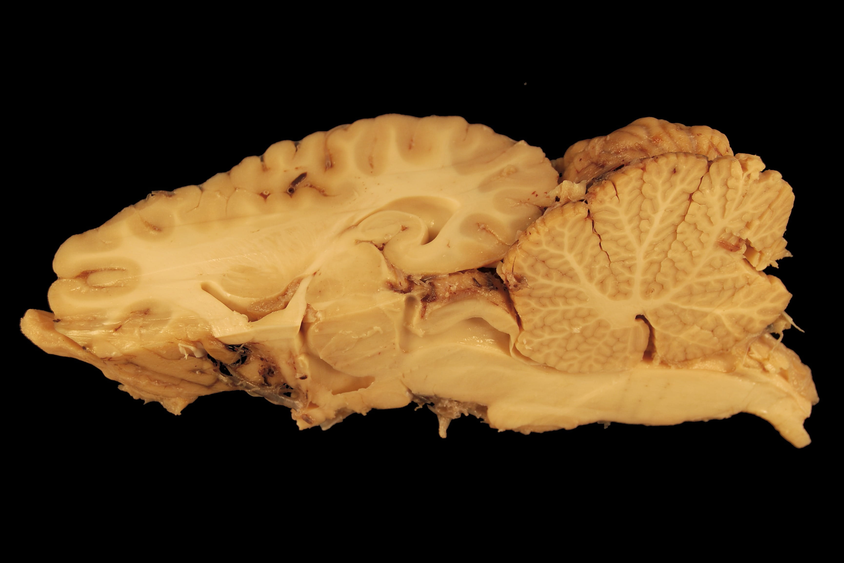 black background, black color, studio shot, rose, cerebrum, science, cut out, anatomy, still life, cerebellum, fragility, close-up, Horse, white matter, HD Wallpaper