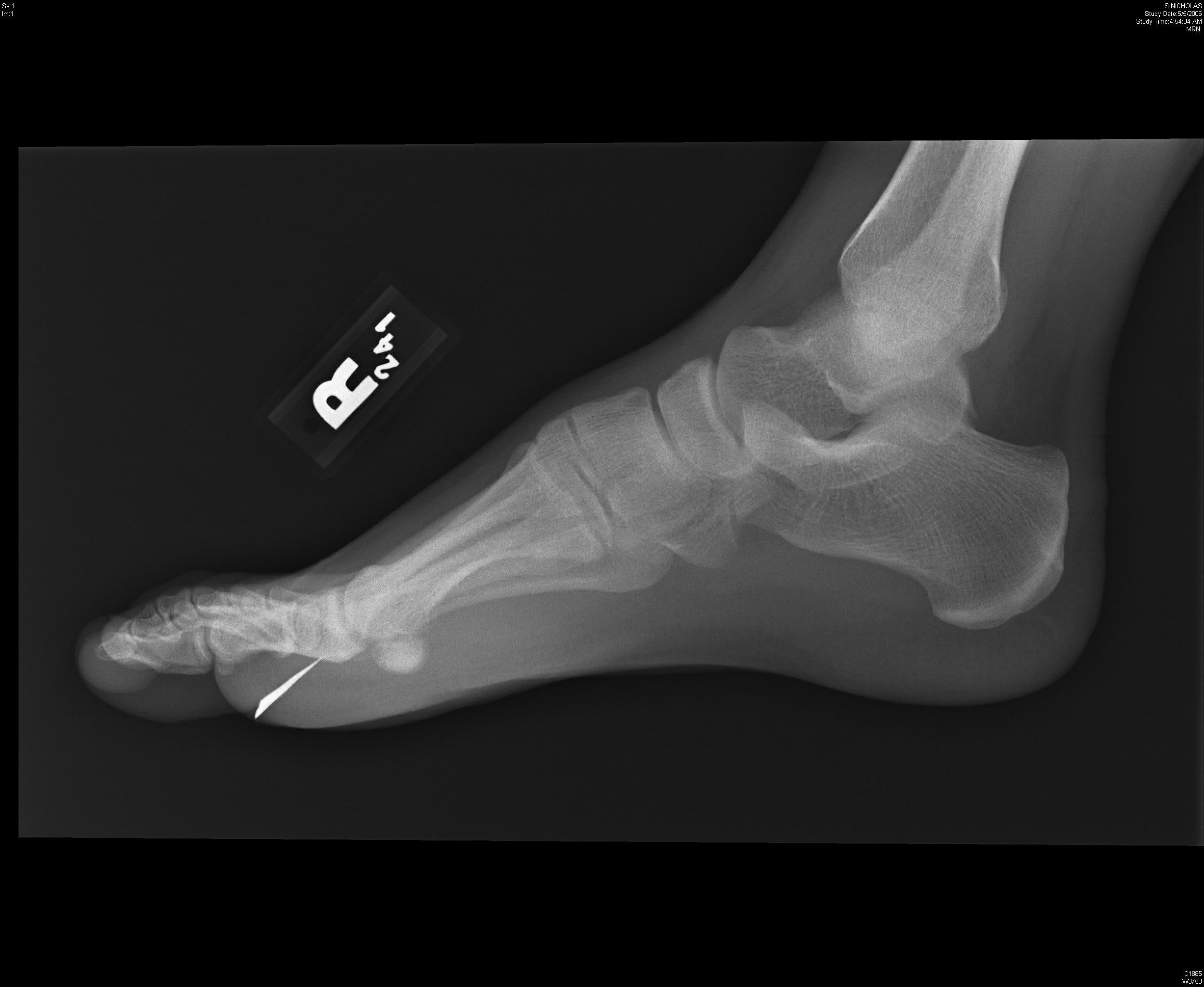 feet, x, art, people, hd, Xray, 1080P, HD Wallpaper