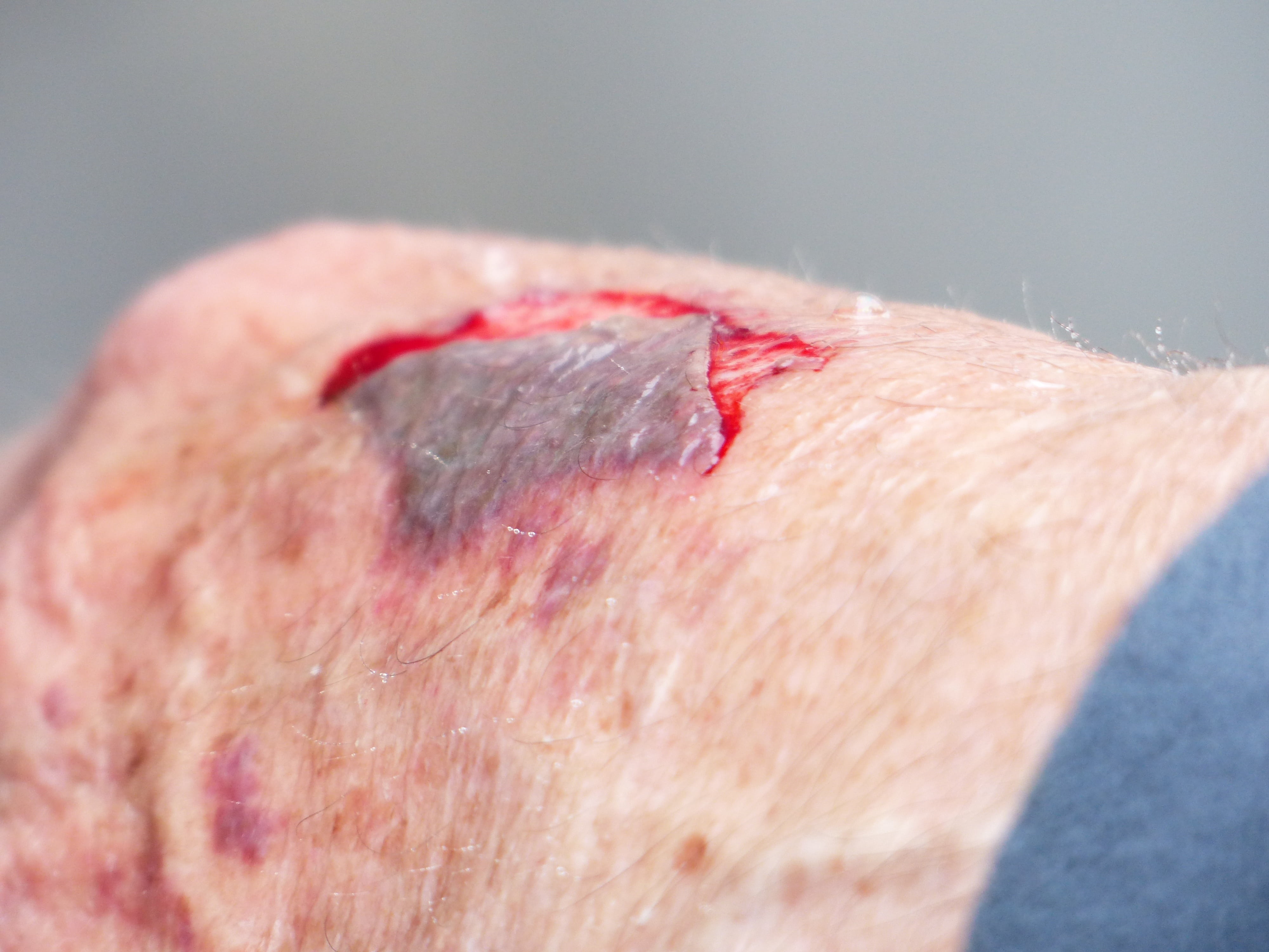 body part, wound, misfortune, indoors, adult, medical condition, bloody, physical injury, red, illness, skin abrasion, human skin, human body part, human blood, HD Wallpaper