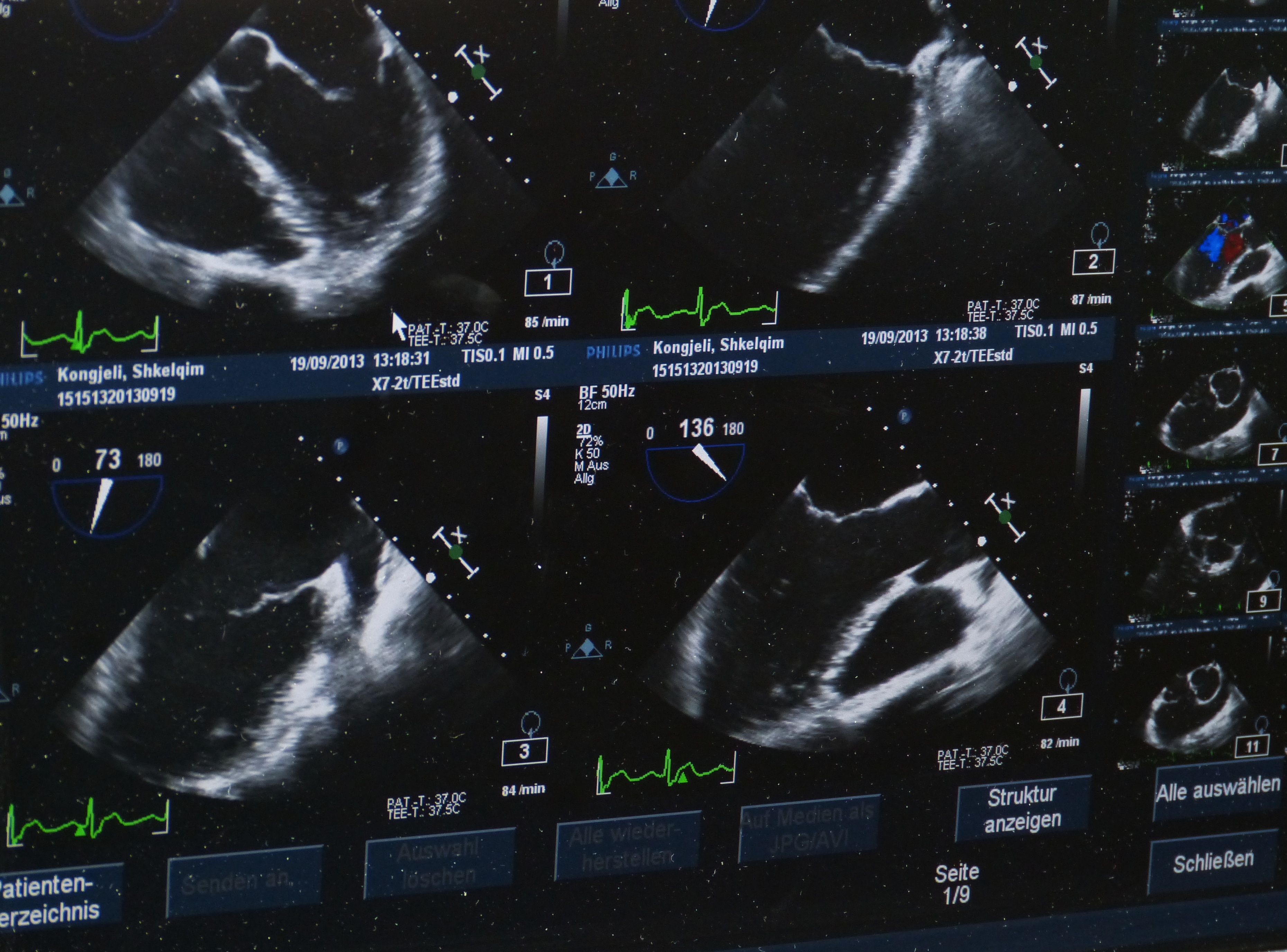 diagram, medical, equipment, ct, music, health check, x ray image, result, technology, text, audio equipment, night, arts culture and entertainment, scan, HD Wallpaper
