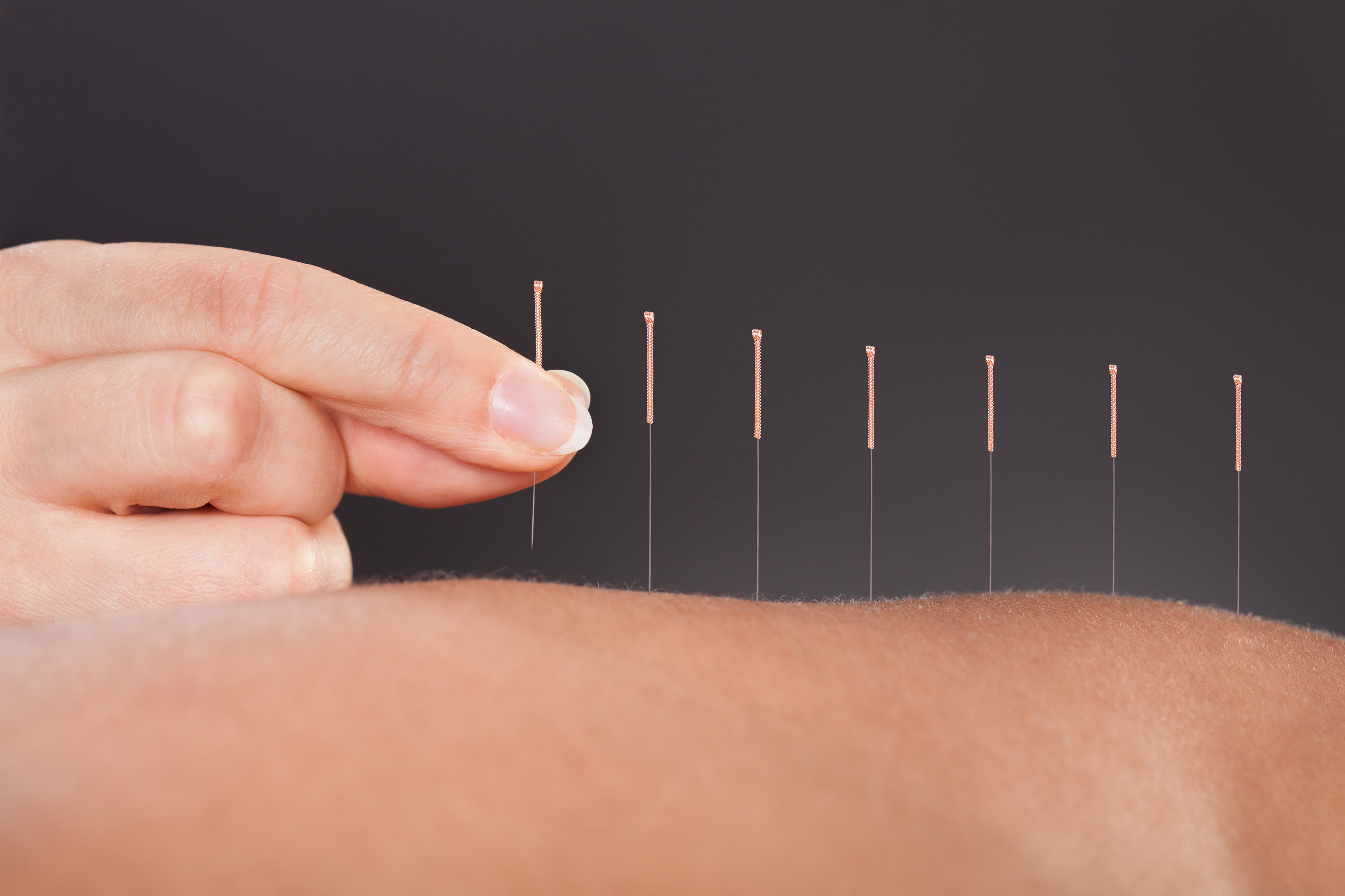 back, fingers, acupuncture, skin, 4K, HD Wallpaper