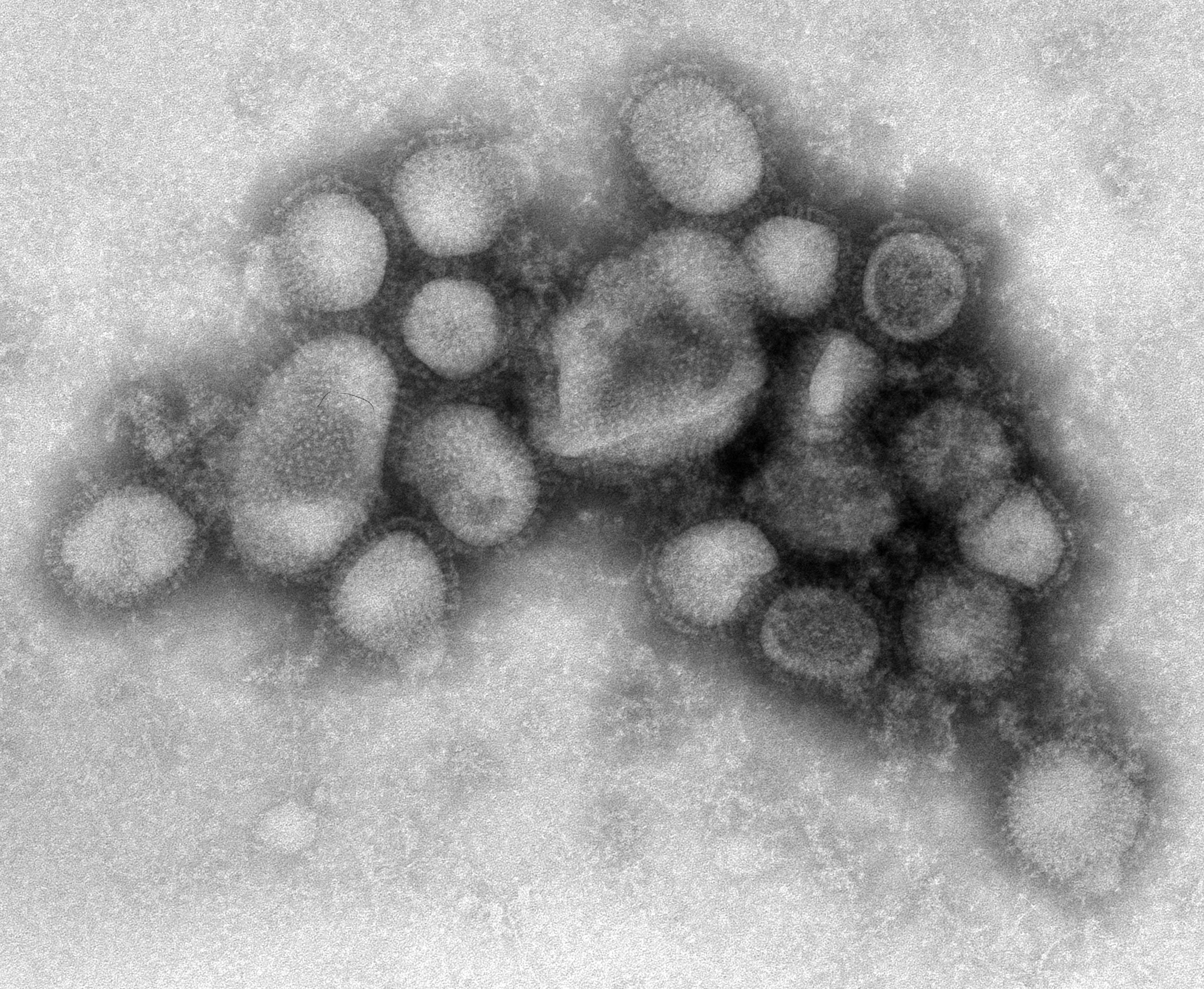 Medical, Disease, flu, 1080P, Virus, HD Wallpaper